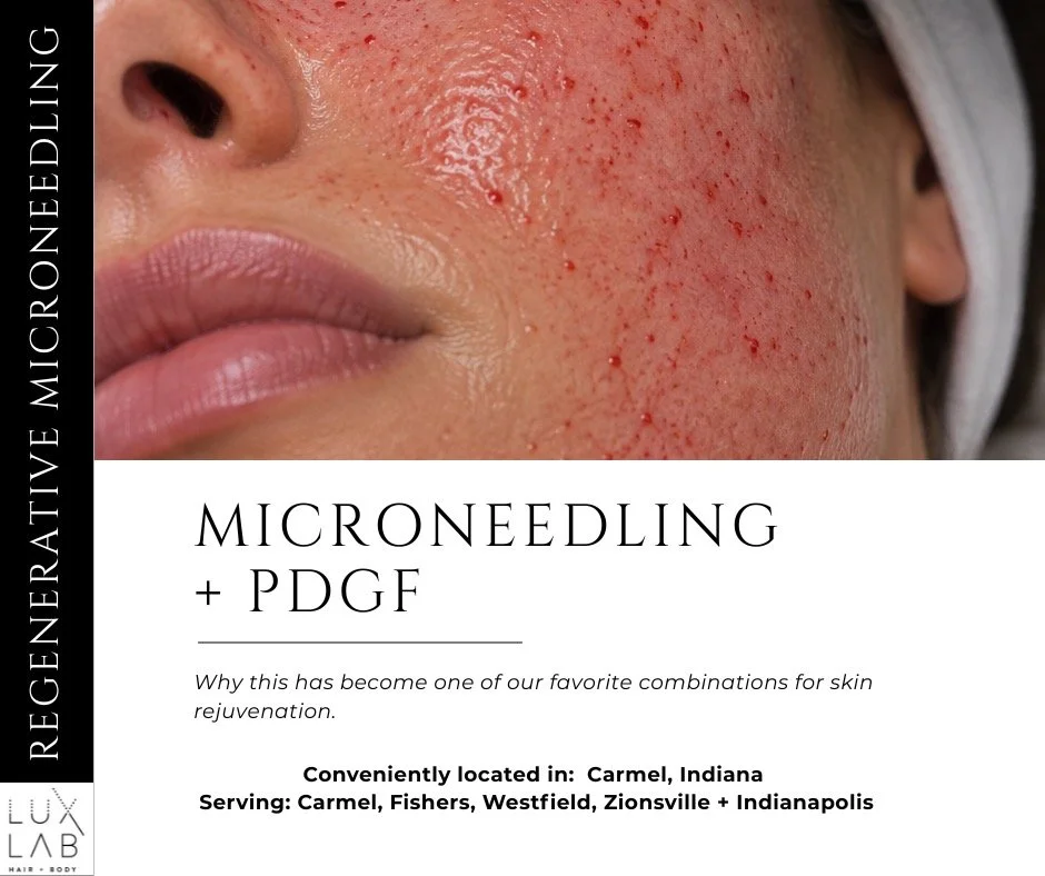 Microneedling + PDGF: Why We Love This Combination for Skin Rejuvenation