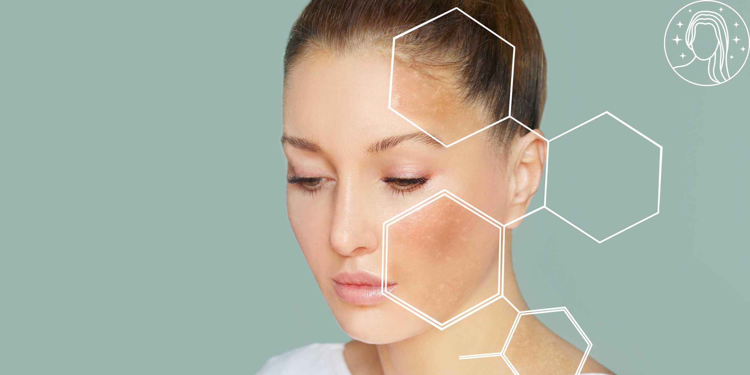 Web_Carousel_BetterSkin.png
