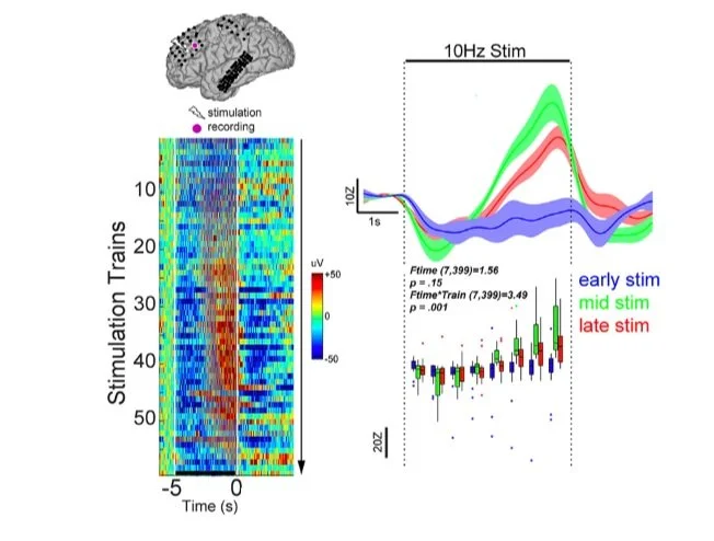 The temporal dynamics during intracranial repetitive stimulation (Huang, et al., Journal of Neuroscience, 2019) 