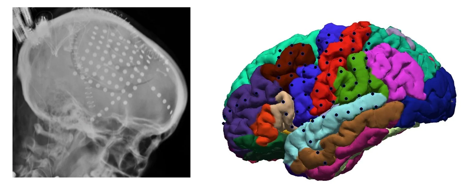 (Keller et al., Journal of Neuroscience, 2013)