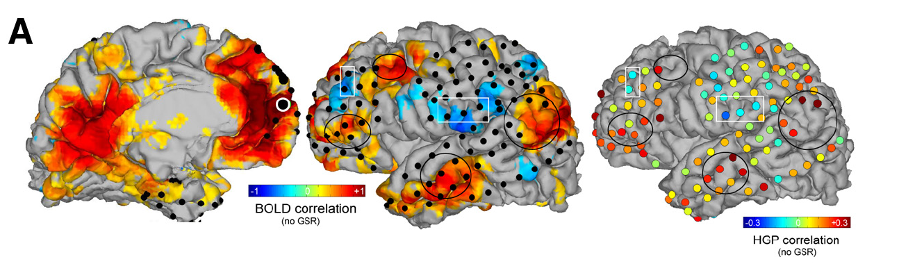 Characterizing high gamma oscillations in the DMN (Unpublished)