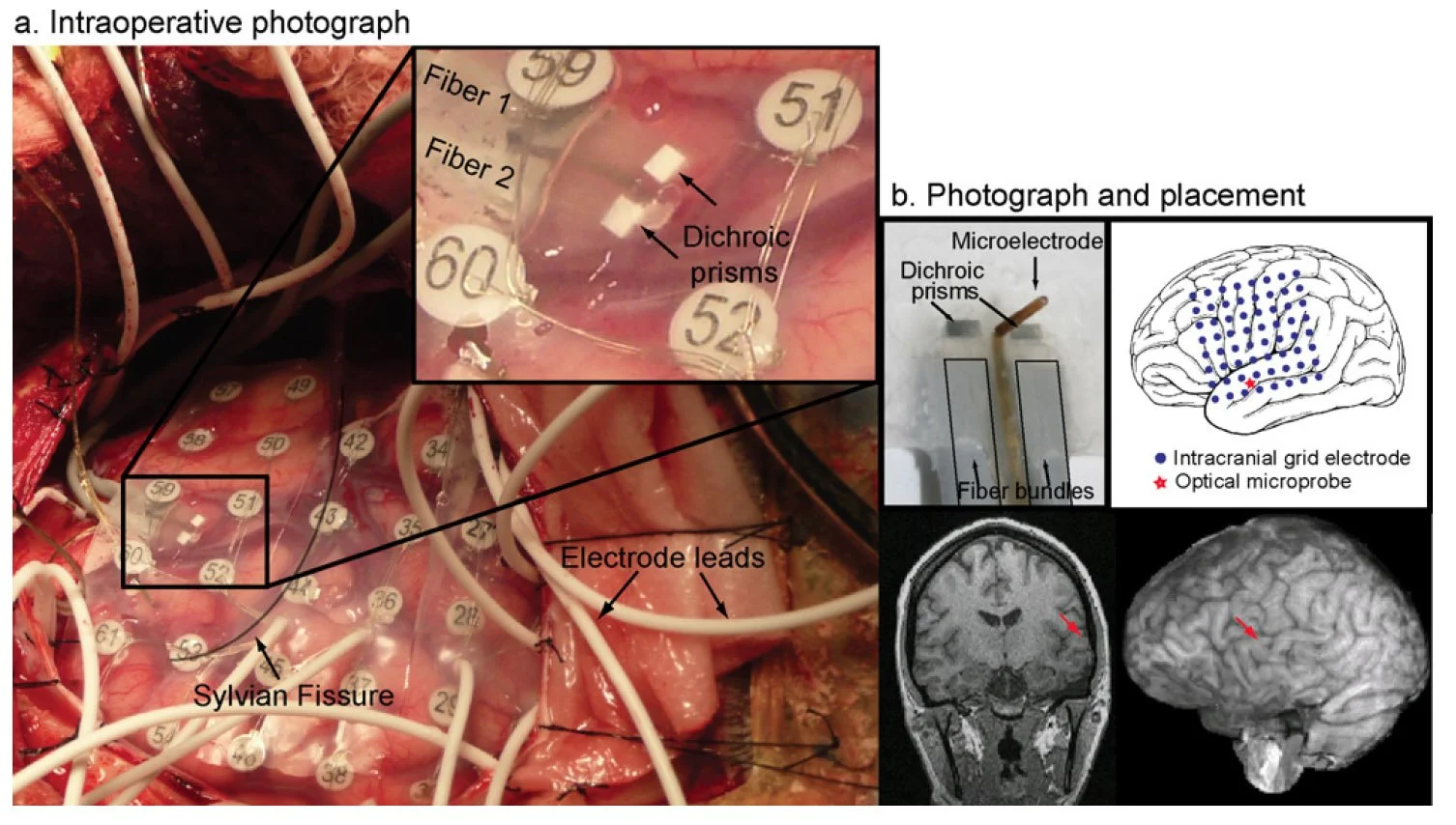 The optode: human laminar electrophysiology and hemodynamics (Keller et al, Journal of Neuroscience Methods, 2009)
