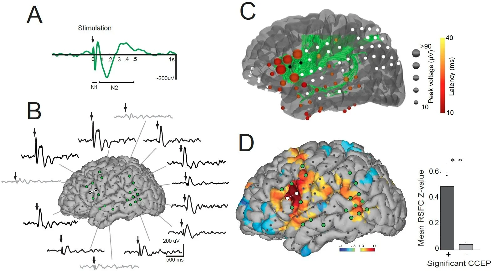 Relating non-invasive resting fMRI maps to intracranial EEG (Keller et al., Proceedings of the National Academy of Sciences, 2011)