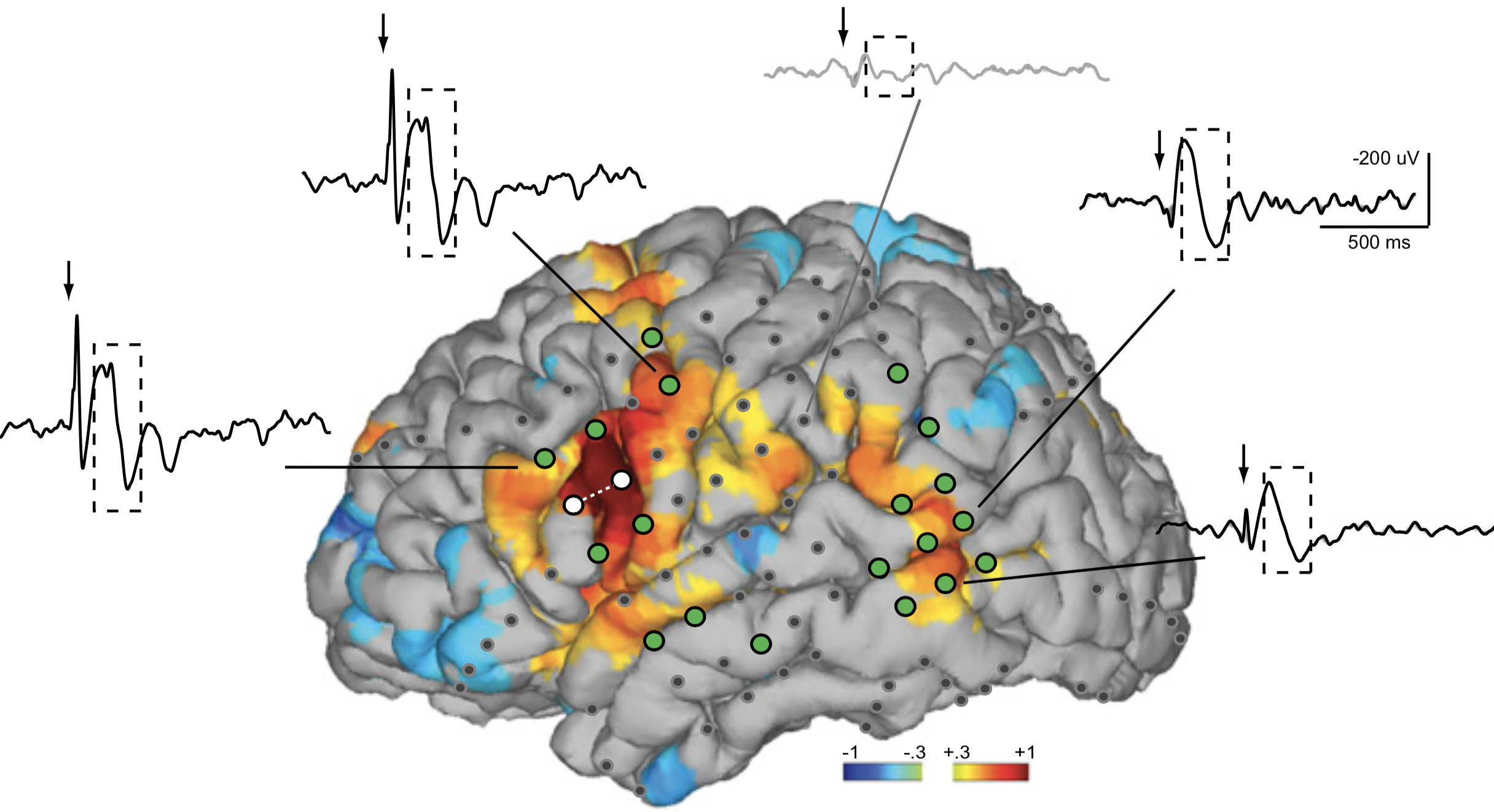 Relating non-invasive resting fMRI maps to intracranial EEG (Keller et al., Proceedings of the National Academy of Sciences, 2011) 