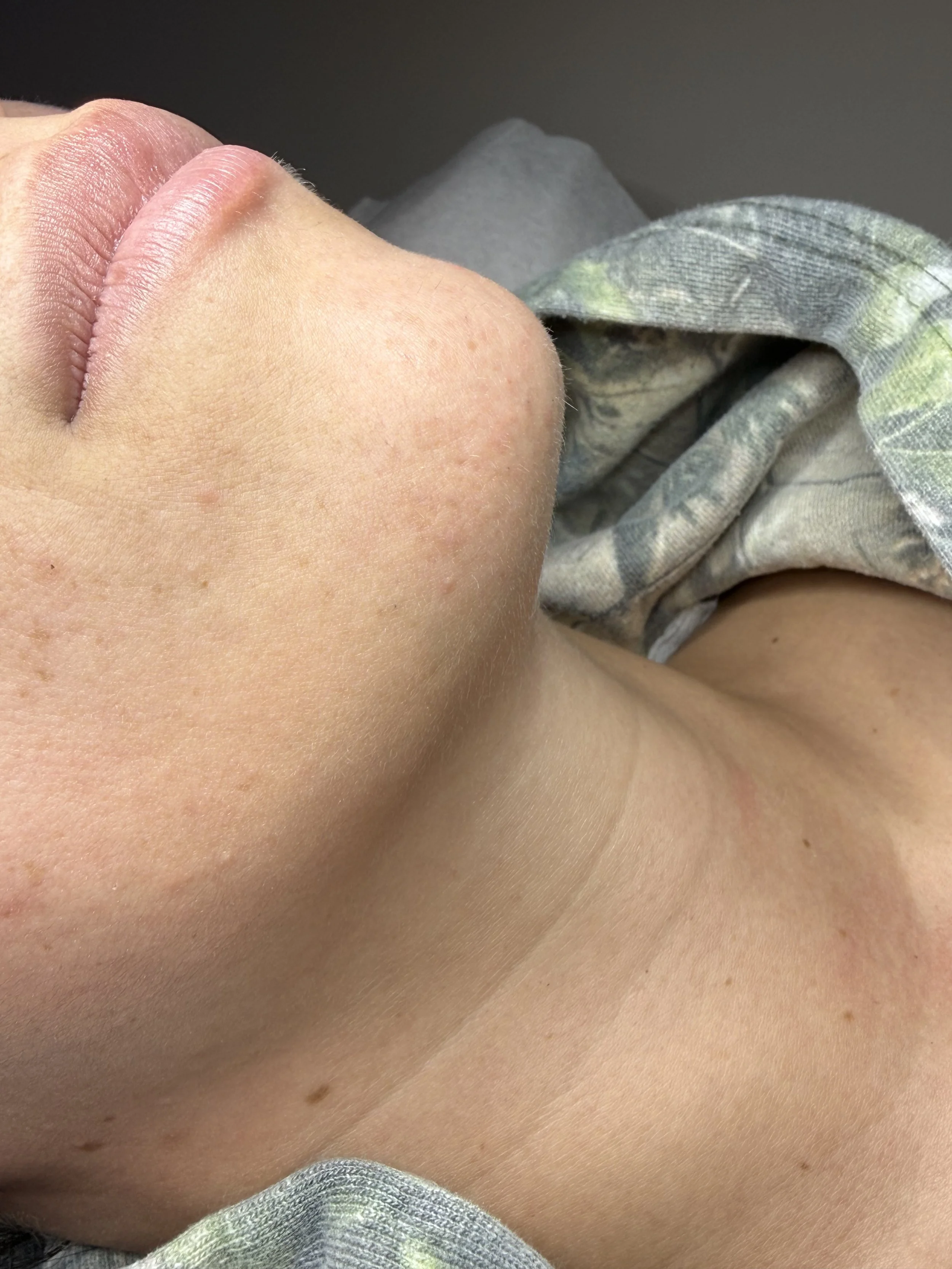 Close-up of a person's face and neck lying down, with a focus on skin texture and facial features.