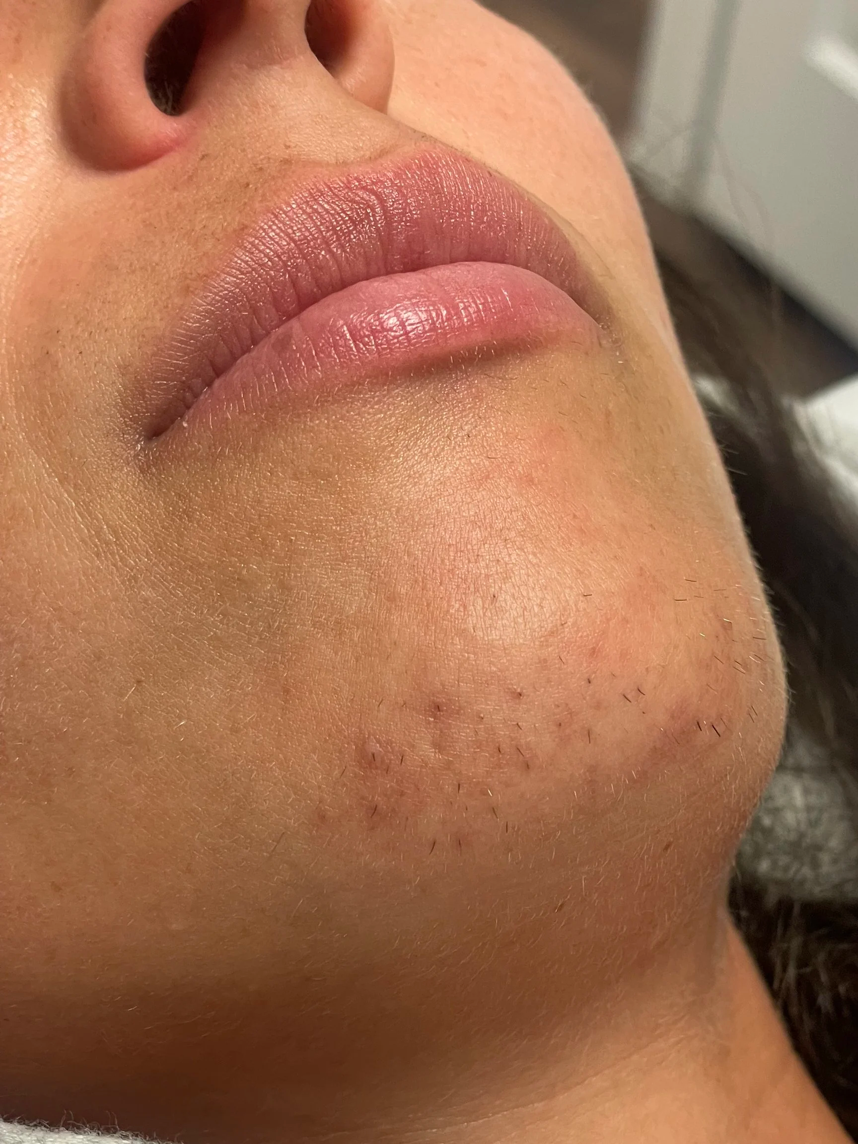 Close-up of a person's lips, chin, and lower face, with visible skin pores, facial hair stubble, and natural skin texture.