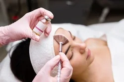 Retinol Peel: Target Pigment, Texture, and Pore Size—Without Downtime