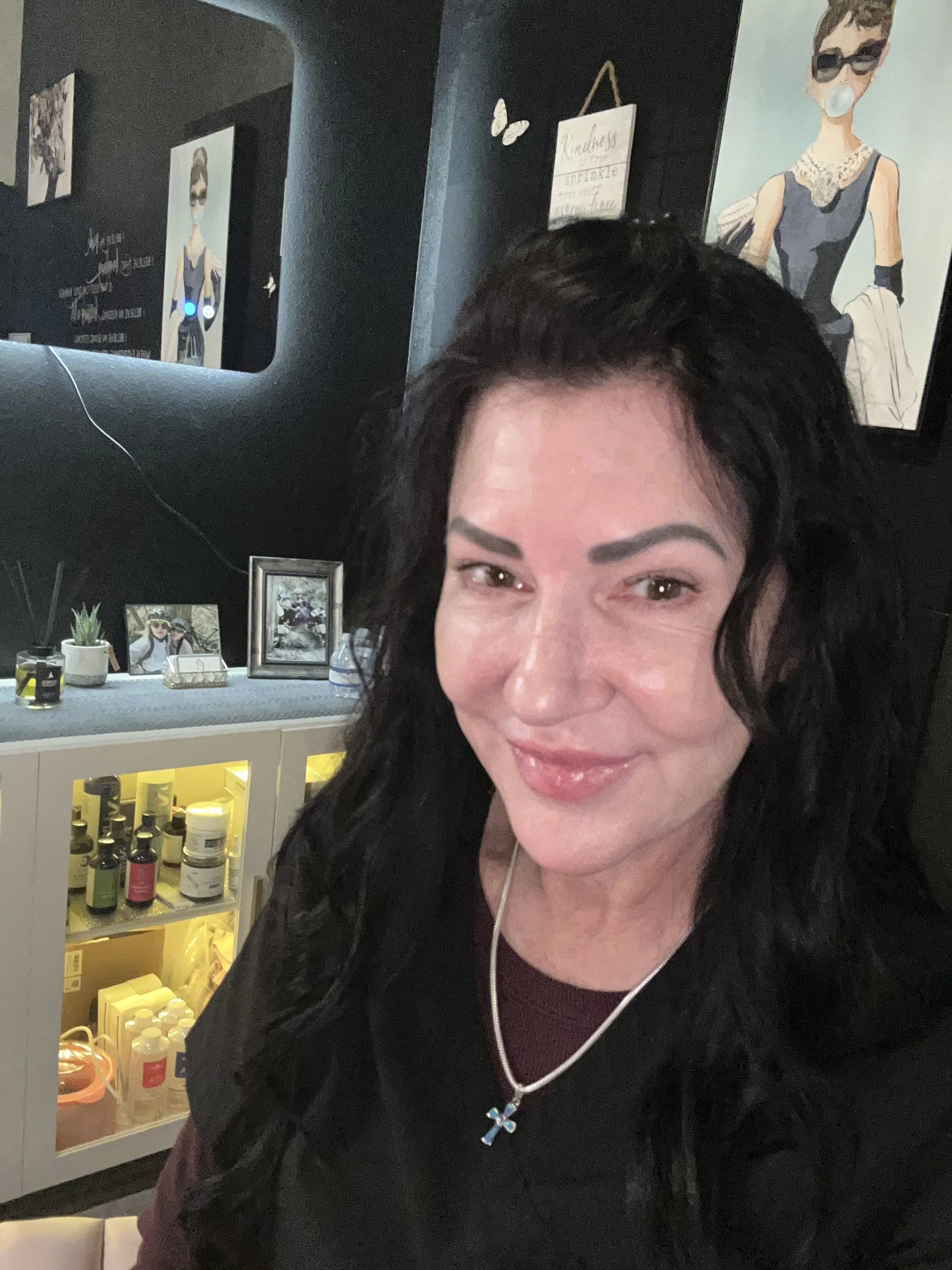 Thinking About Microneedling in Orange City, FL? Here’s What You Should Know