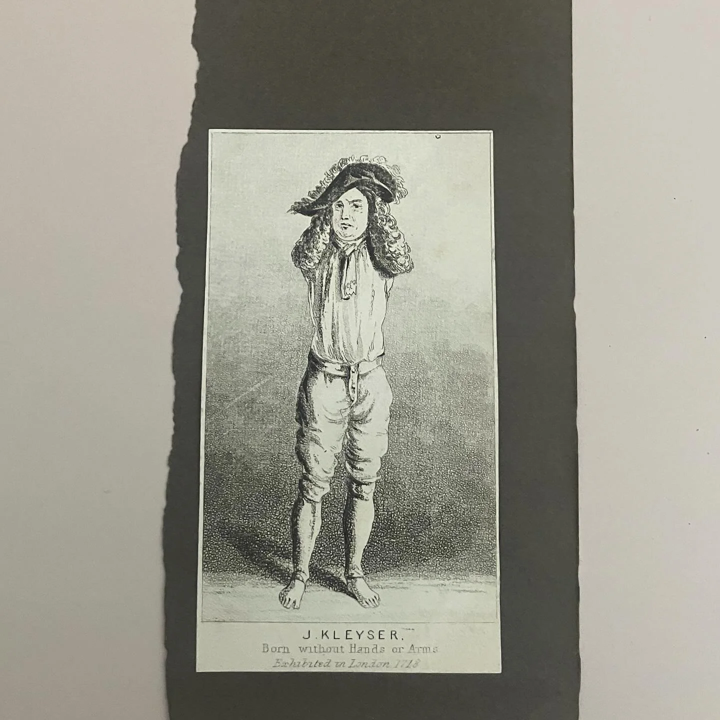In 1718, Johann Kleyser exhibited himself and had his disabilities documented in London. Little appears to be known about the circumstances - whether he was paid, if he was coerced, whether it was intended as scientific or sociological study, or if t