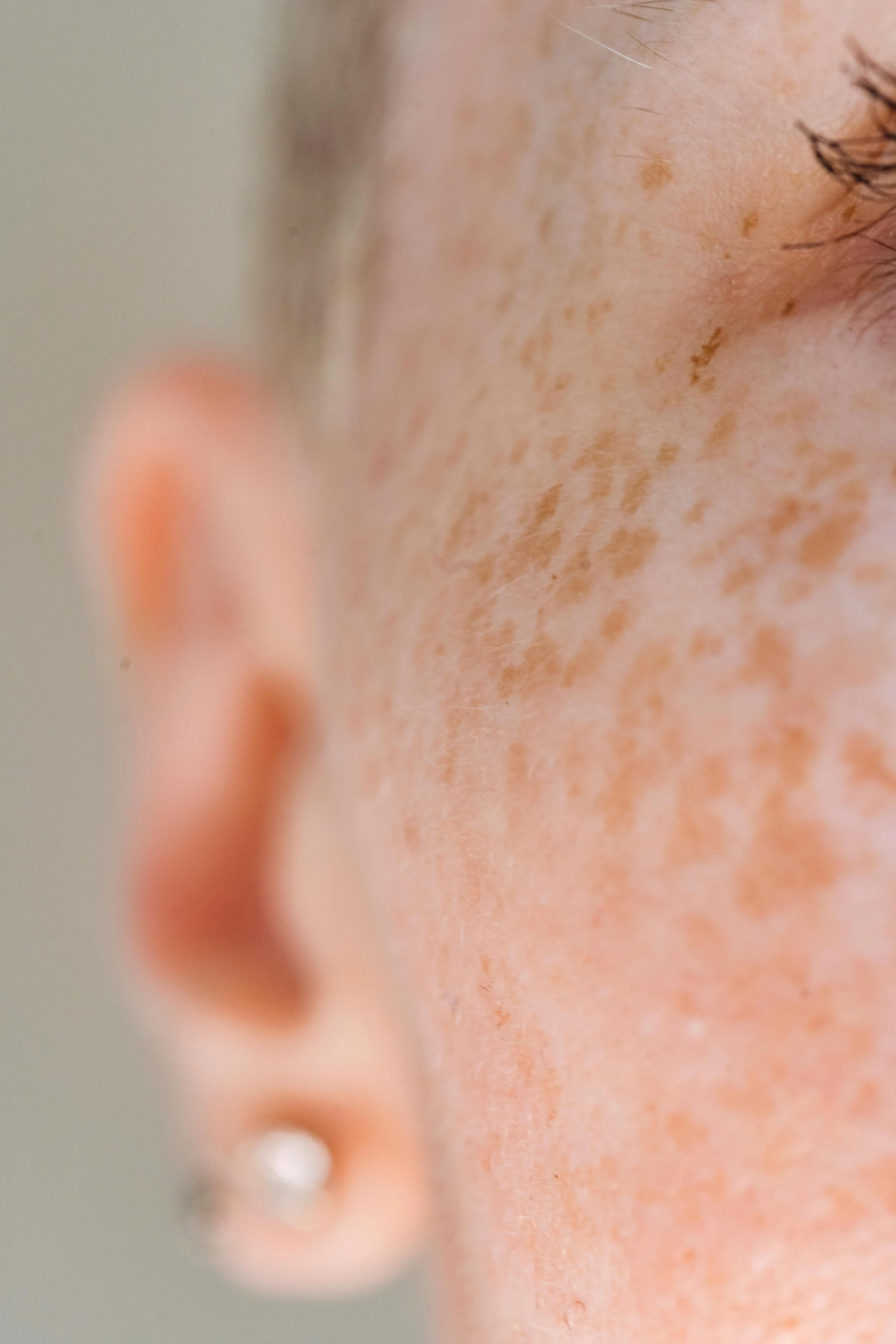 Close-up of a person's cheek with freckles, part of the ear with a earring, and closed eye with a few eyelashes visible.