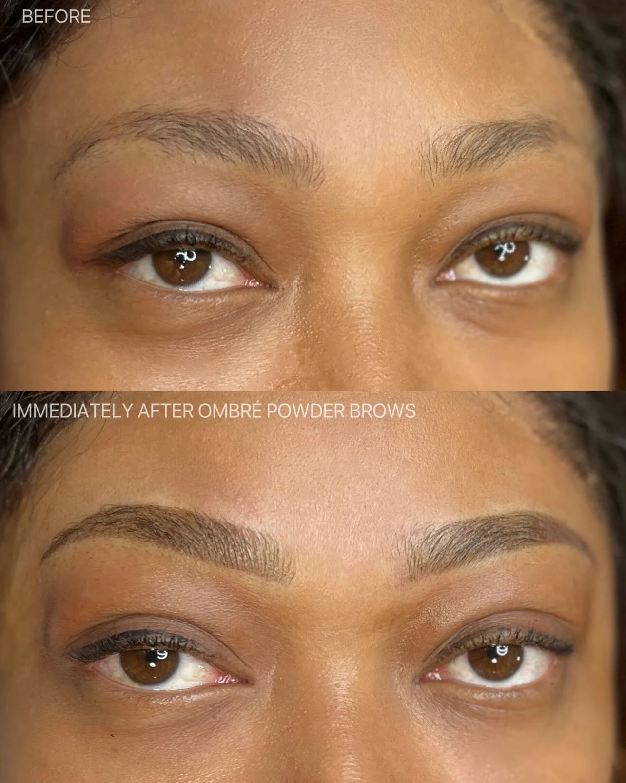 ✨ Soft Ombr&eacute; Powder Brows ✨
The most versatile brow technique you&rsquo;ll ever try! Whether you love a bold, defined look or prefer something soft and natural, ombr&eacute; powder brows can be tailored just for you.
This technique gives a sof