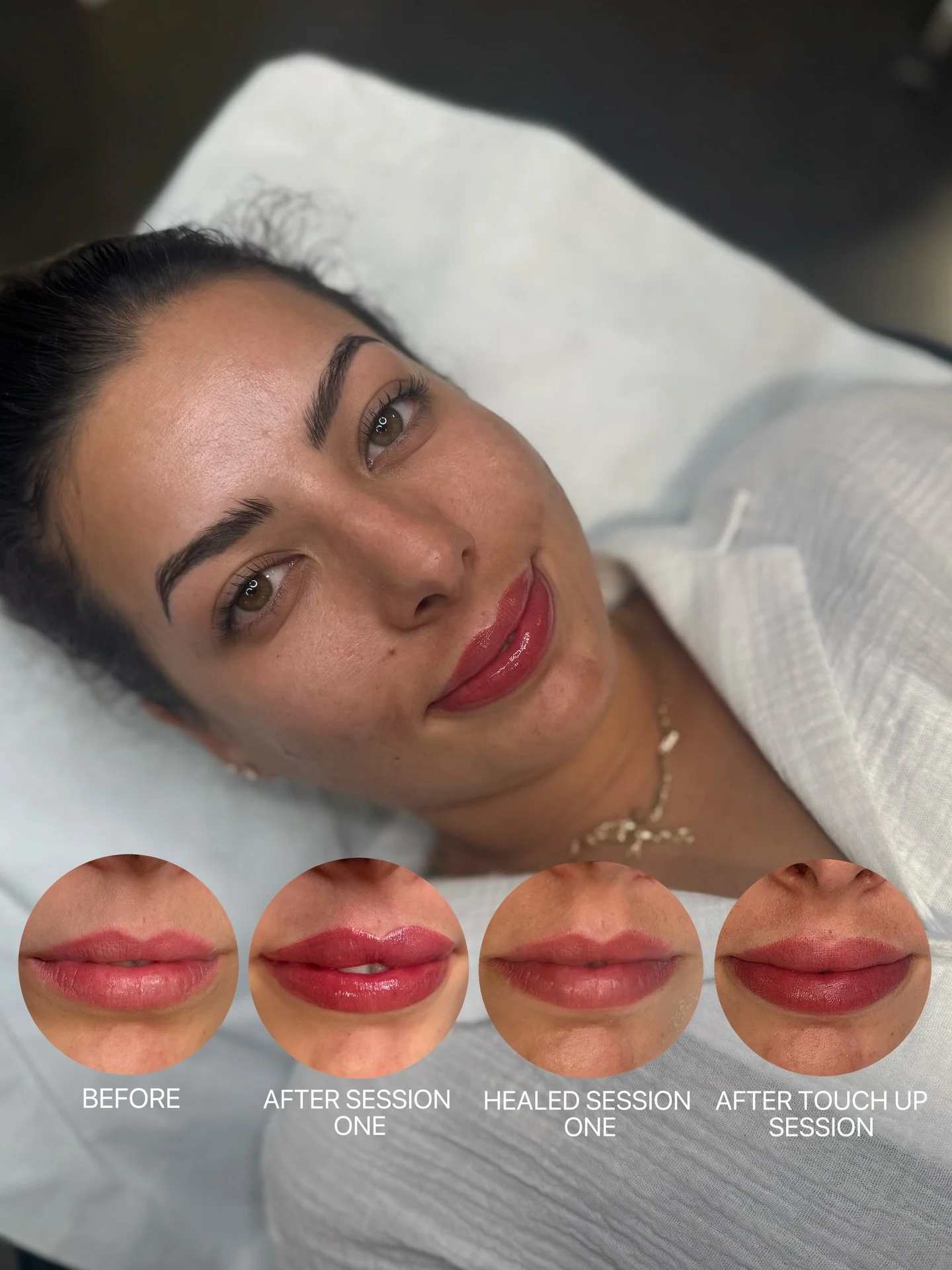 Lip blush correction ✨

My clients previous lip tattoo healed too bright pink for her skin tone and extended slightly outside the natural lip border, creating a blurry healed result.

The skin outside the lip border is different from the lip tissue, 