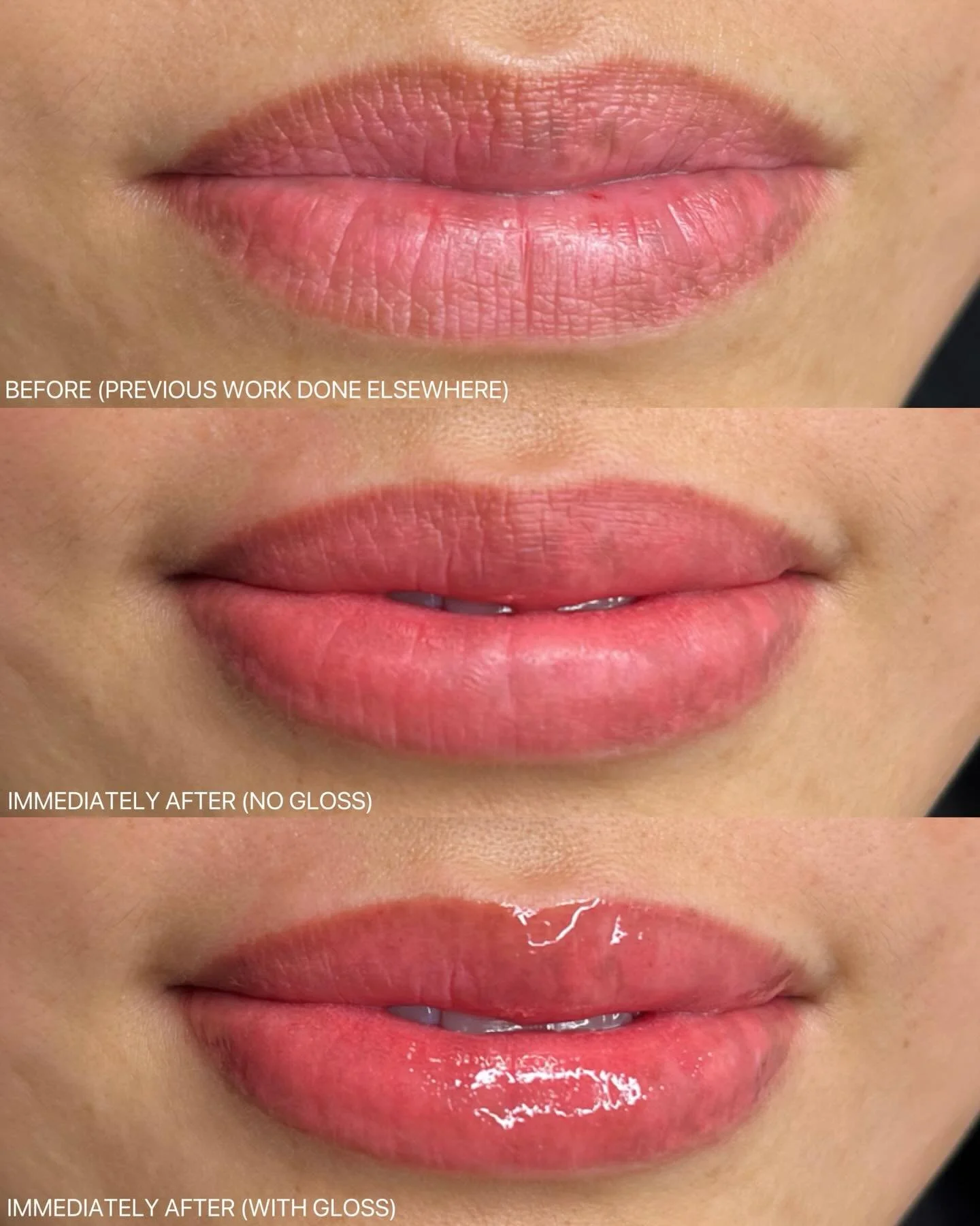 Soft borderless lip blush tattoo ✨

Lip Blush Benefits ✅
&bull; Enhances natural lip color
&bull; Creates a fuller, more defined look
&bull; Improves lip symmetry
&bull; Long-lasting results (no daily reapplying!)
&bull; Gives a soft, youthful tint
&