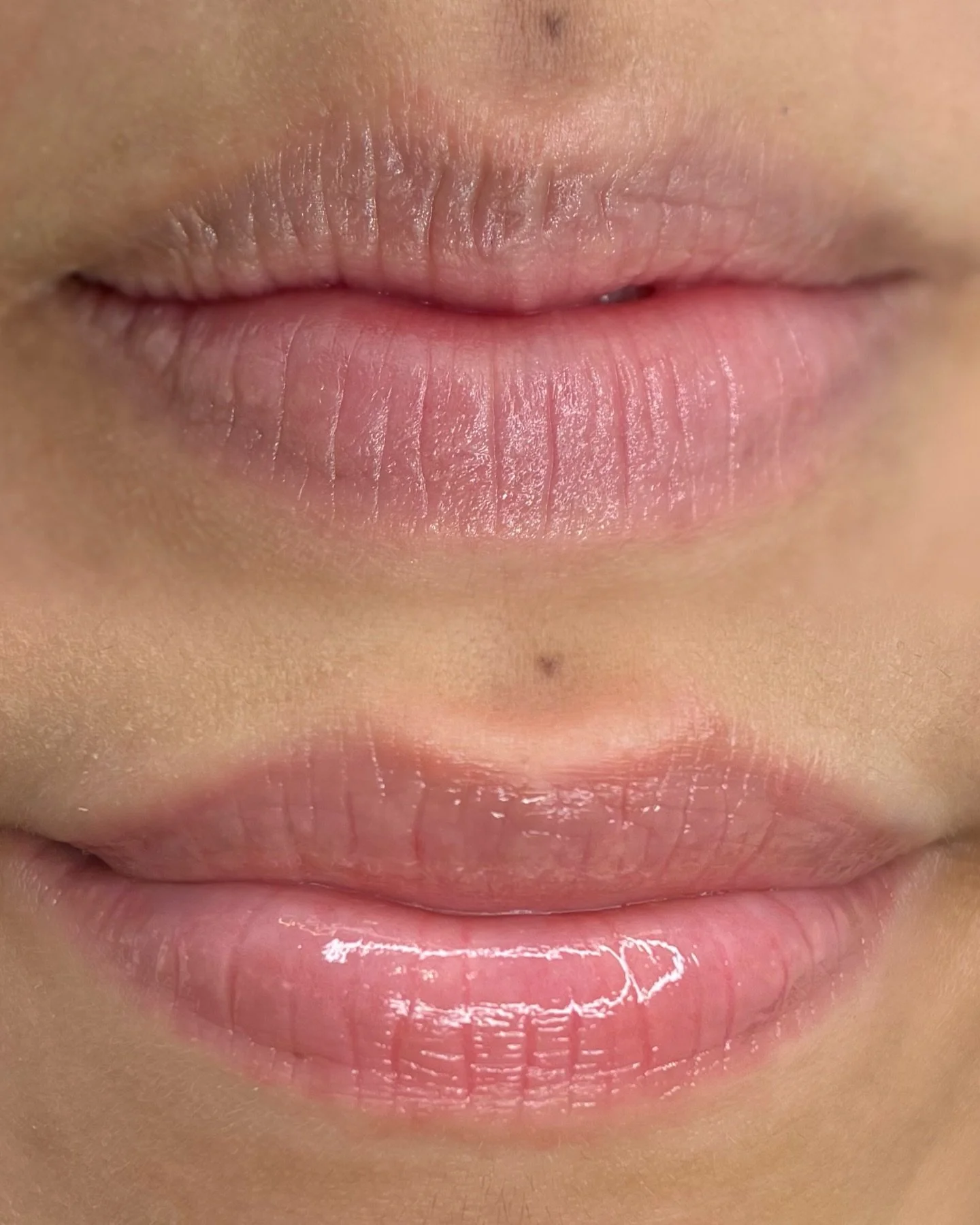 Natural healed lip tint enhancement 💕 The goal? No one knows you got it done 👀

No harsh lines. No heavy colour.
Just a soft, natural tint that enhances what you already have. 

This treatment is perfect if you:
&bull; Have pale or uneven lips
&bul