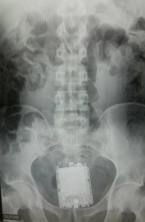 Everyone F***s Up: Four Steps To Turn Your Mistakes Into Opportunities For Growth