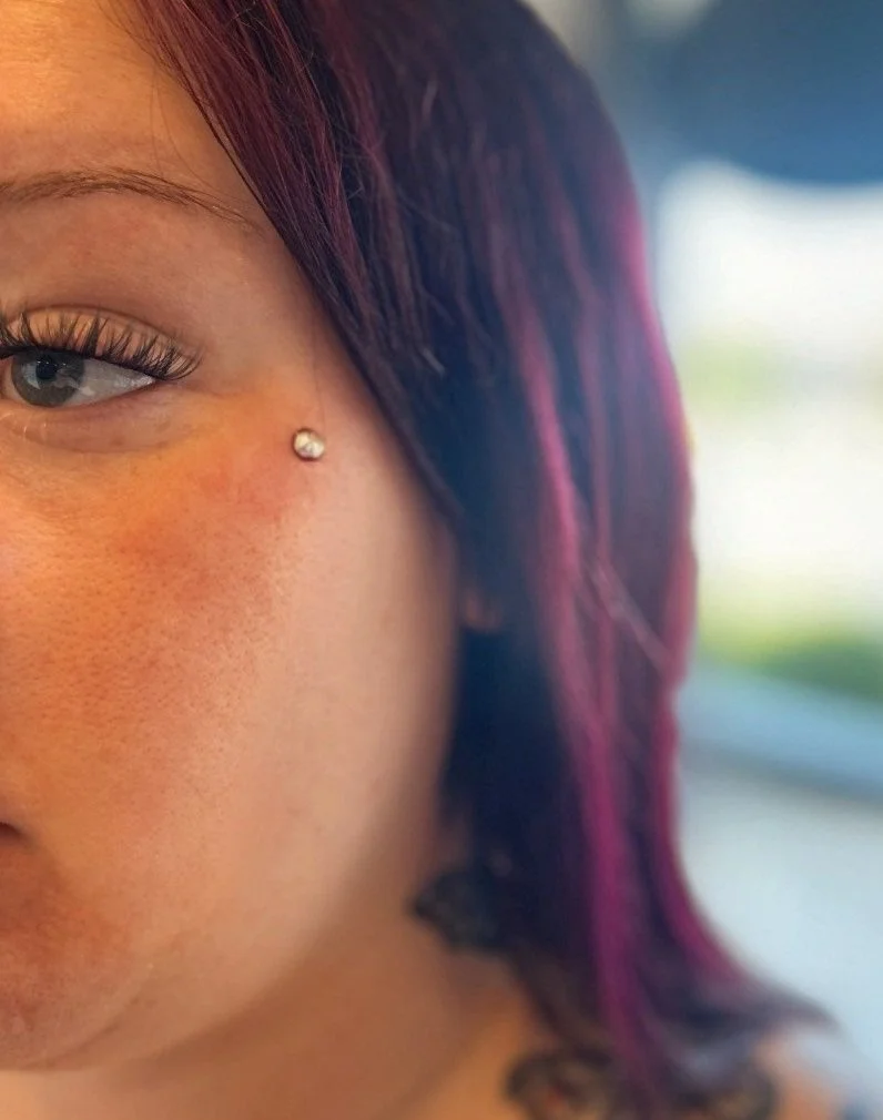 Dermal