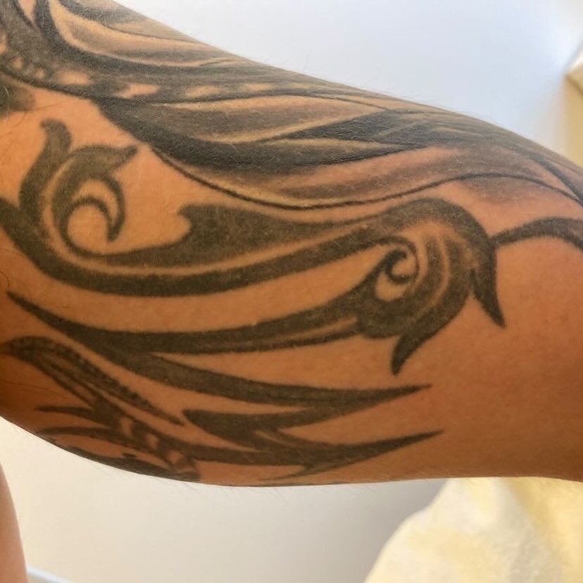 Tatoveringsfjernelse med PicoPlus hos NUDE! 💥

Coveup &amp; F&aelig;rdig! - Marcin har i alt gennemg&aring;et 4 behandlinger af hans tatovering p&aring; indersiden af overarmen. M&aring;let med tatoveringsfjernelsen var at klarg&oslash;re tatovering