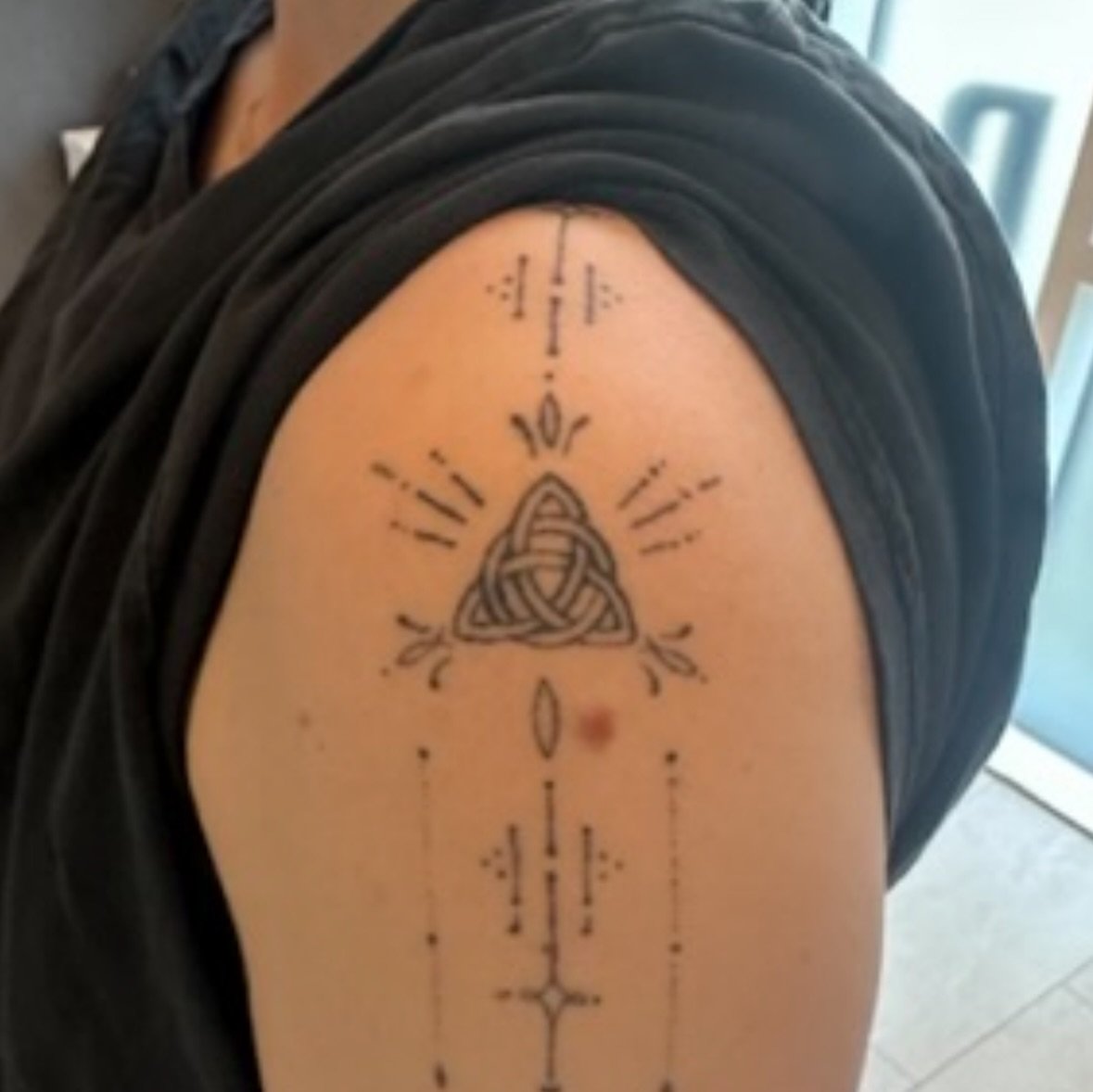 Tatoveringsfjernelse med PicoPlus hos NUDE! 💥

F&aelig;rdig! - Sofie har i alt gennemg&aring;et 9 behandlinger af hendes tatovering p&aring; overarmen. I dag gav vi hende sidste behandling for at komme helt i m&aring;l. Vi har som udgangspunkt givet