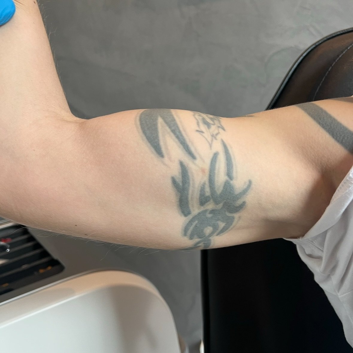 Tatoveringsfjernelse med PicoPlus hos NUDE! 💥

F&aelig;rdig! - Henrik var en af mange kunder, der i g&aring;r afsluttede sin tatoveringsfjernelse. M&aring;let var at forberede huden til et coverup. Normalt d&aelig;mpes tatoveringen ikke s&aring; meg