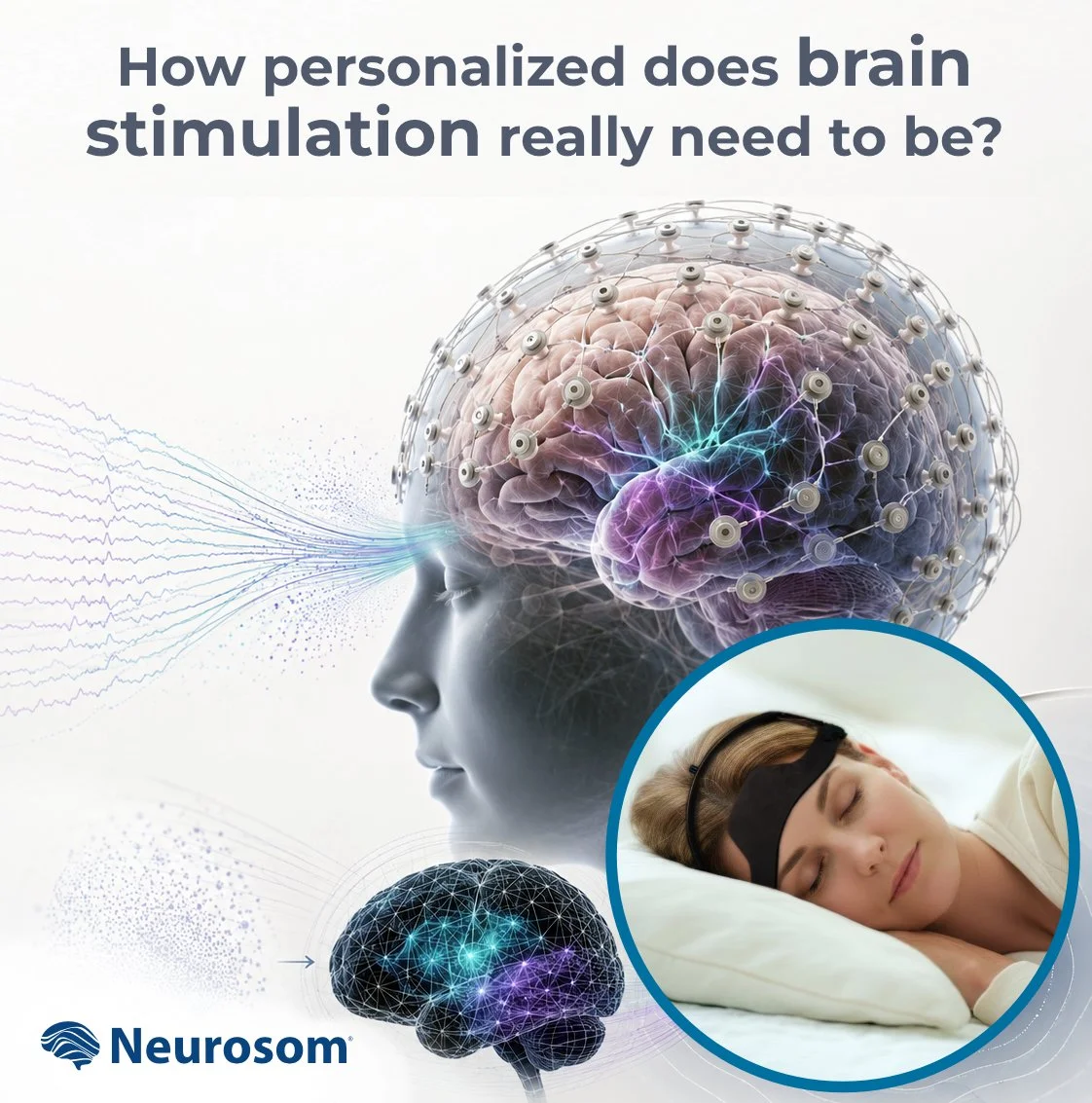 How personalized does brain stimulation really need to be?
