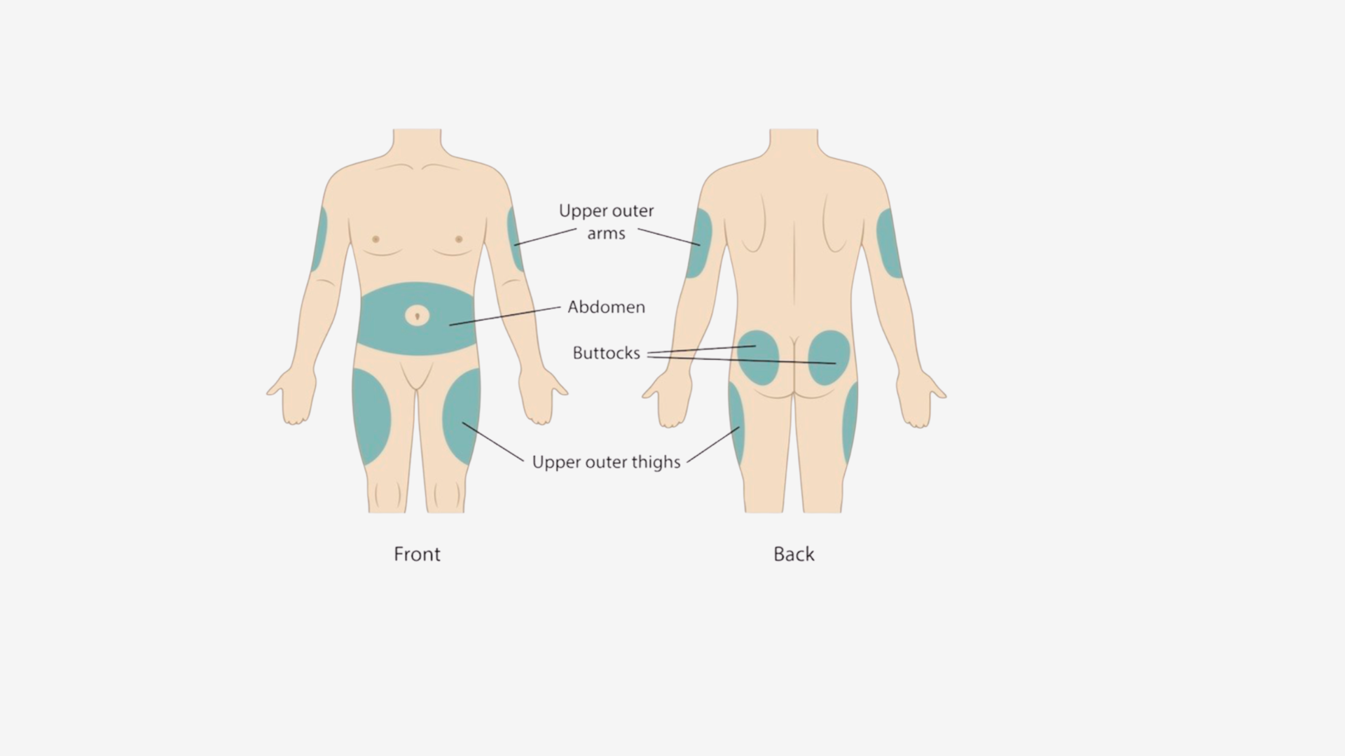 Subcut Injection Leg How to Give Yourself a Subcutaneous Injection Safely — Dr. Gail King ...