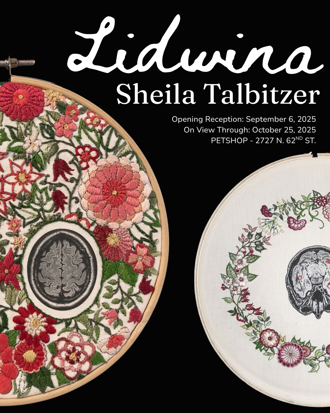 Lidwina - Sheila Talbitzer