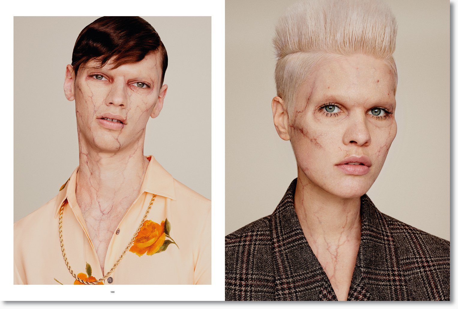 Zwei Porträts von Frauen mit deutlich sichtbaren, ausgeprägten Narben im Gesicht und am Hals, beide tragen unterschiedliche Kleidung.