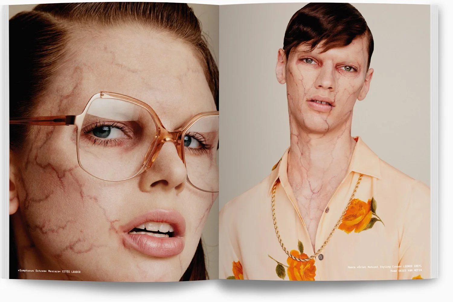 Doppelporträt eines Models mit Kajalstrichen, großen Brille und aufgemalter Haut, auf der linken Seite. Auf der rechten Seite ein Model mit sichtbaren Vasculitis, kürzeren Haaren und gelbem Hemd mit Orangemuster, auch mit Hauterkrankung. Beides zeigt