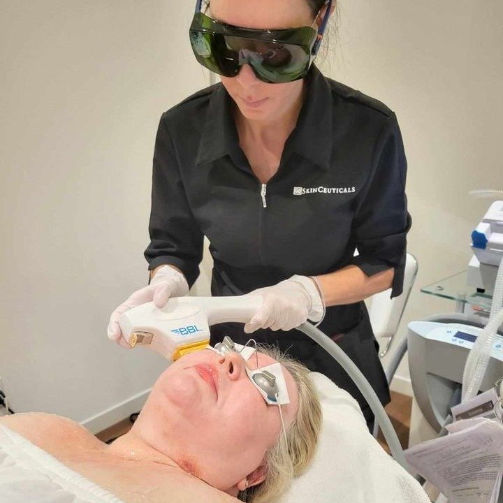 Dr. Karen Edstrom is not only our center's Dermatologist she is our best patient! Here is our Cutis Cutie getting her Fall Favorite treatments.
2 weeks ago Nurse Kristi did a #SkinVive treatment on her face and neck. A week later she had #BBLHero for