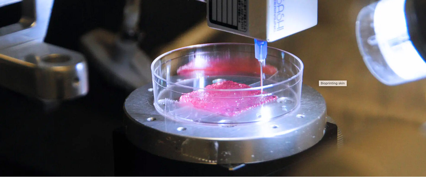Can printed ‘skin’ help to heal burns without scars?