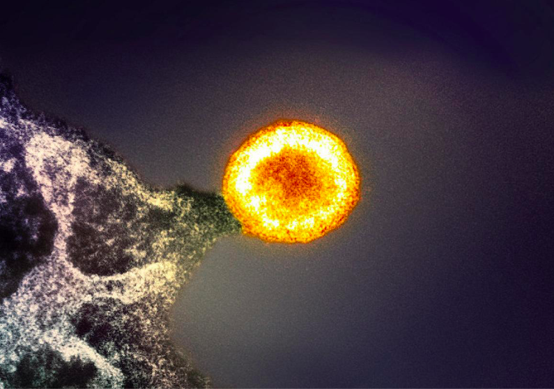 Achieving lasting remission for HIV