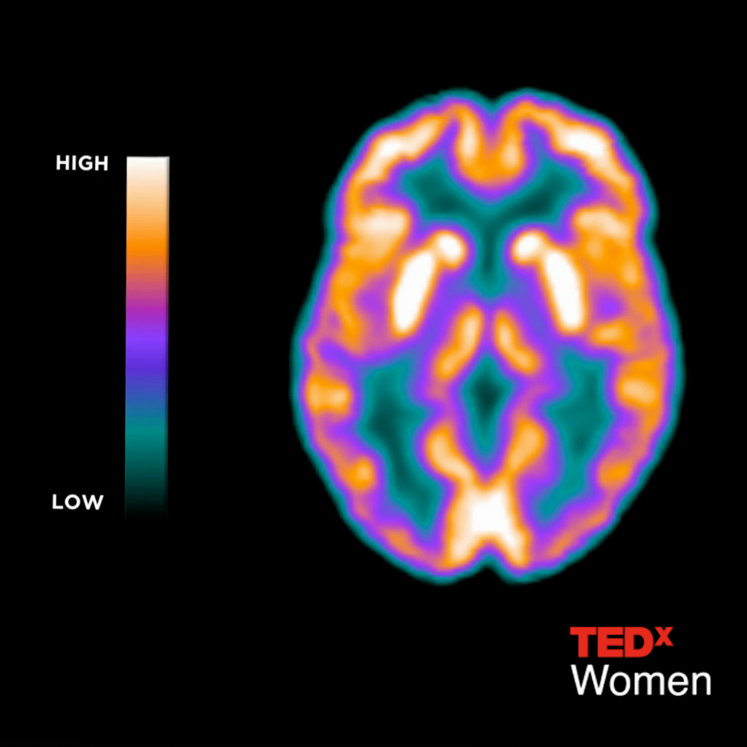 TedX Brain in Menopause.png