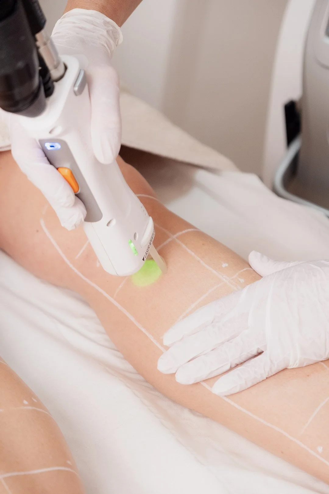 Epilation définitive au laser médical à la clinique Laseo à Bulle, dans le canton de Fribourg