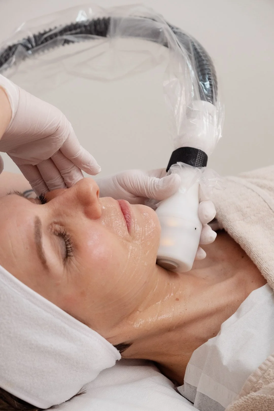 Traitement de cryothérapie dans le but de brûler la graisse par le froid réalisé dans la clinique de médecine esthétique Laseo à Bulle, dans le canton de fribourg.