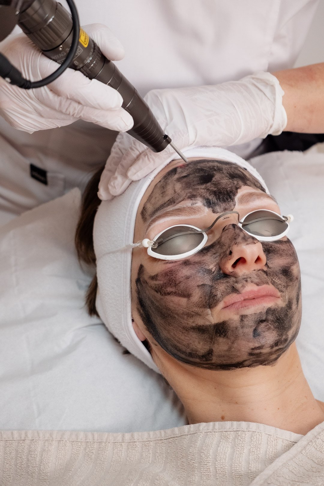 Traitement skincare au laser médical, ici le hollywood Peeling, un peeling laser au charbon, réalisé à la clinique de médecine esthétique Laseo à Bulle