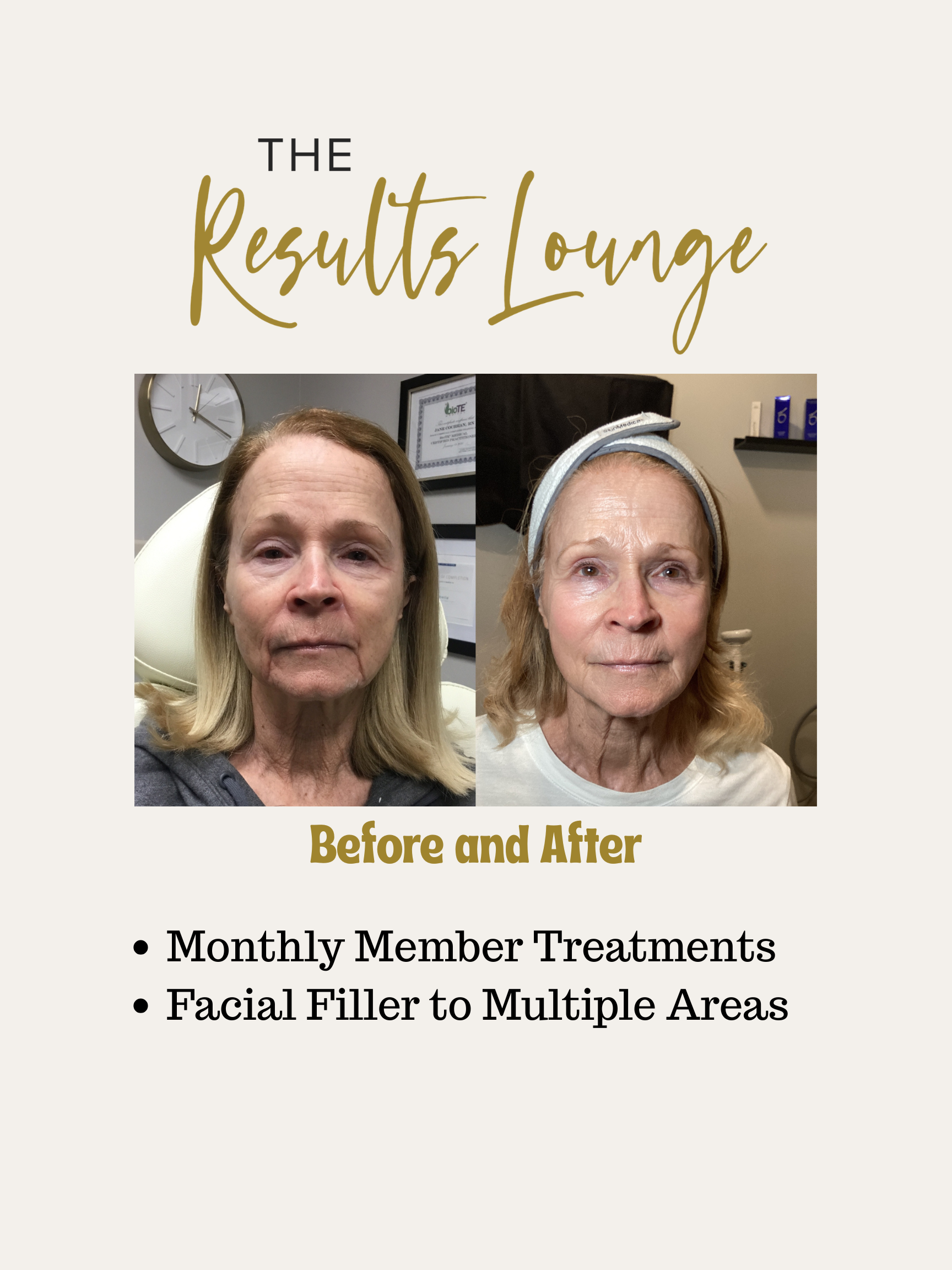 Before and After (20).png