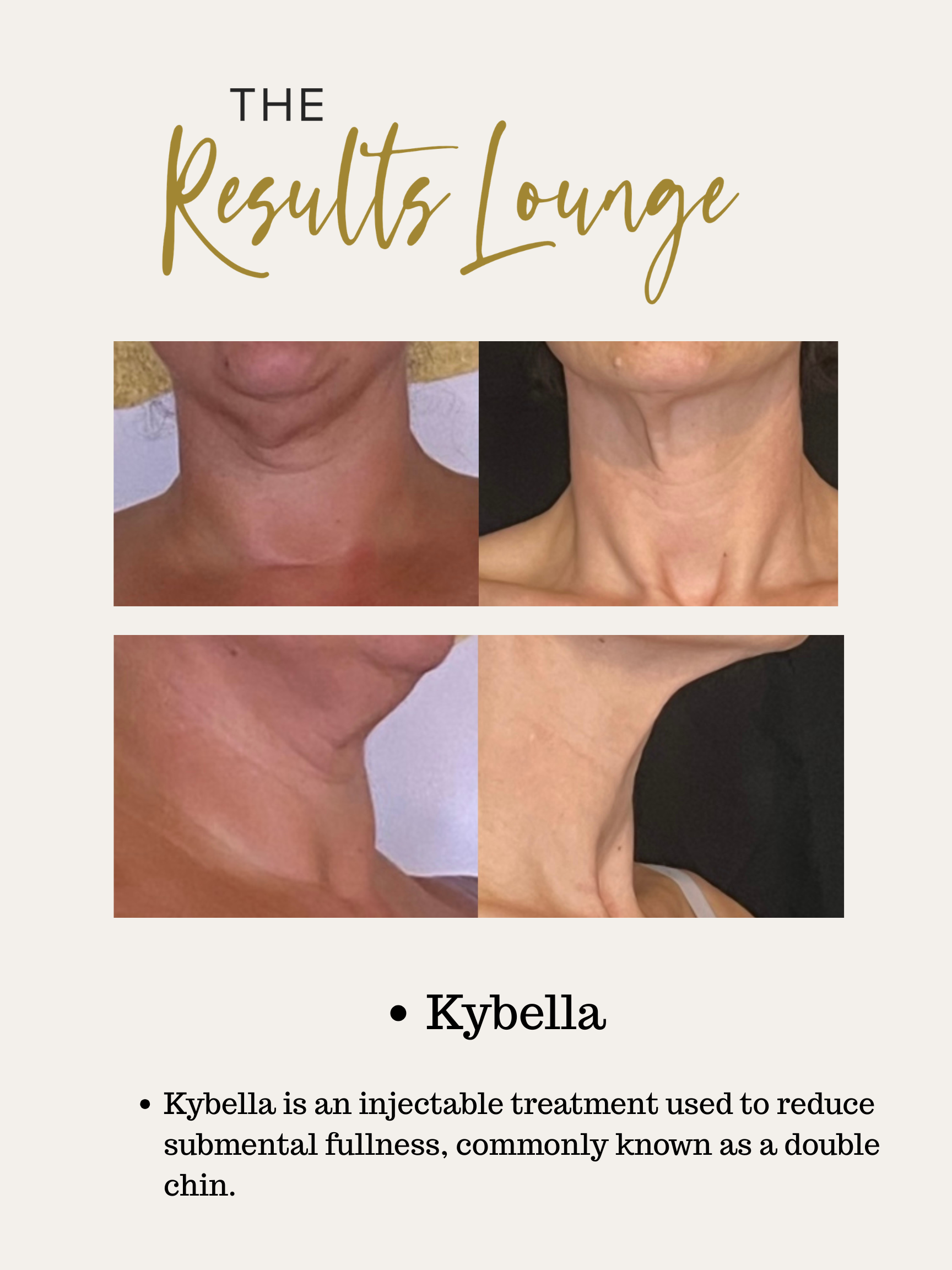 Before and After (12).png