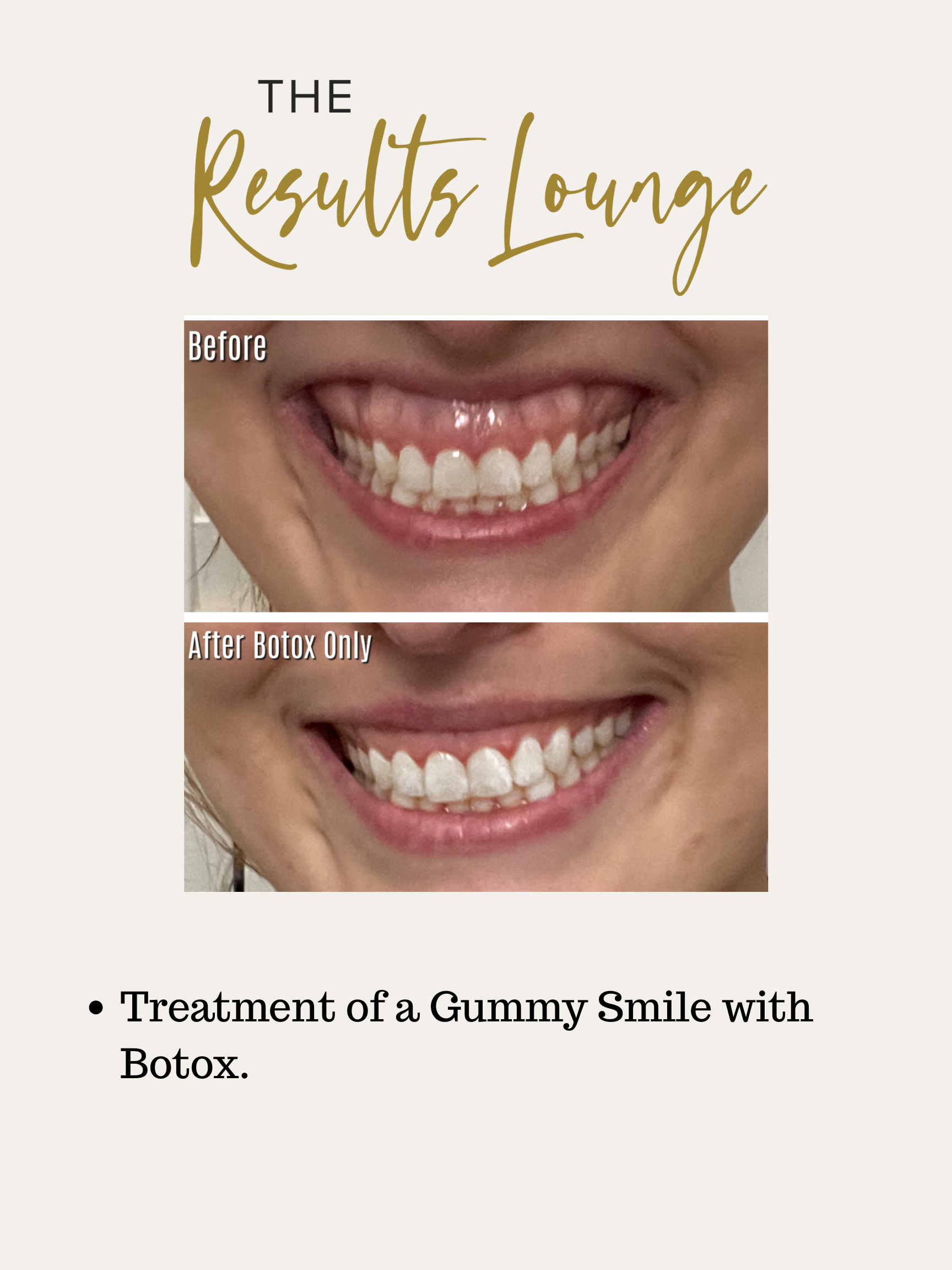 Before and After (17).png