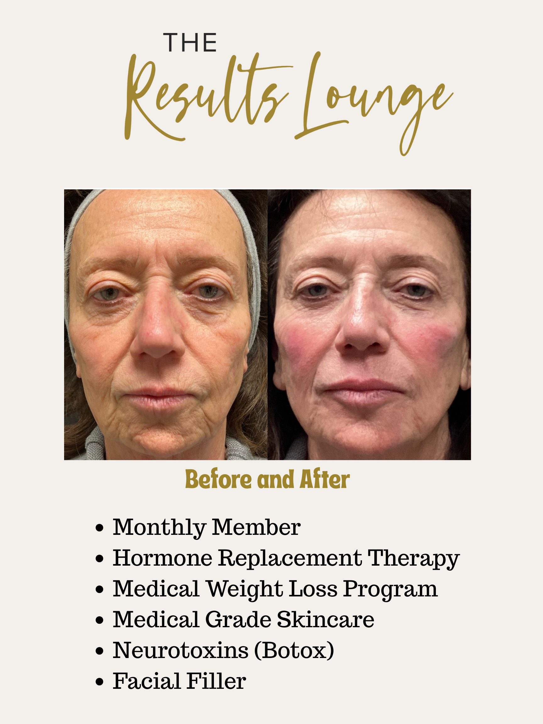 Before and After (1).png