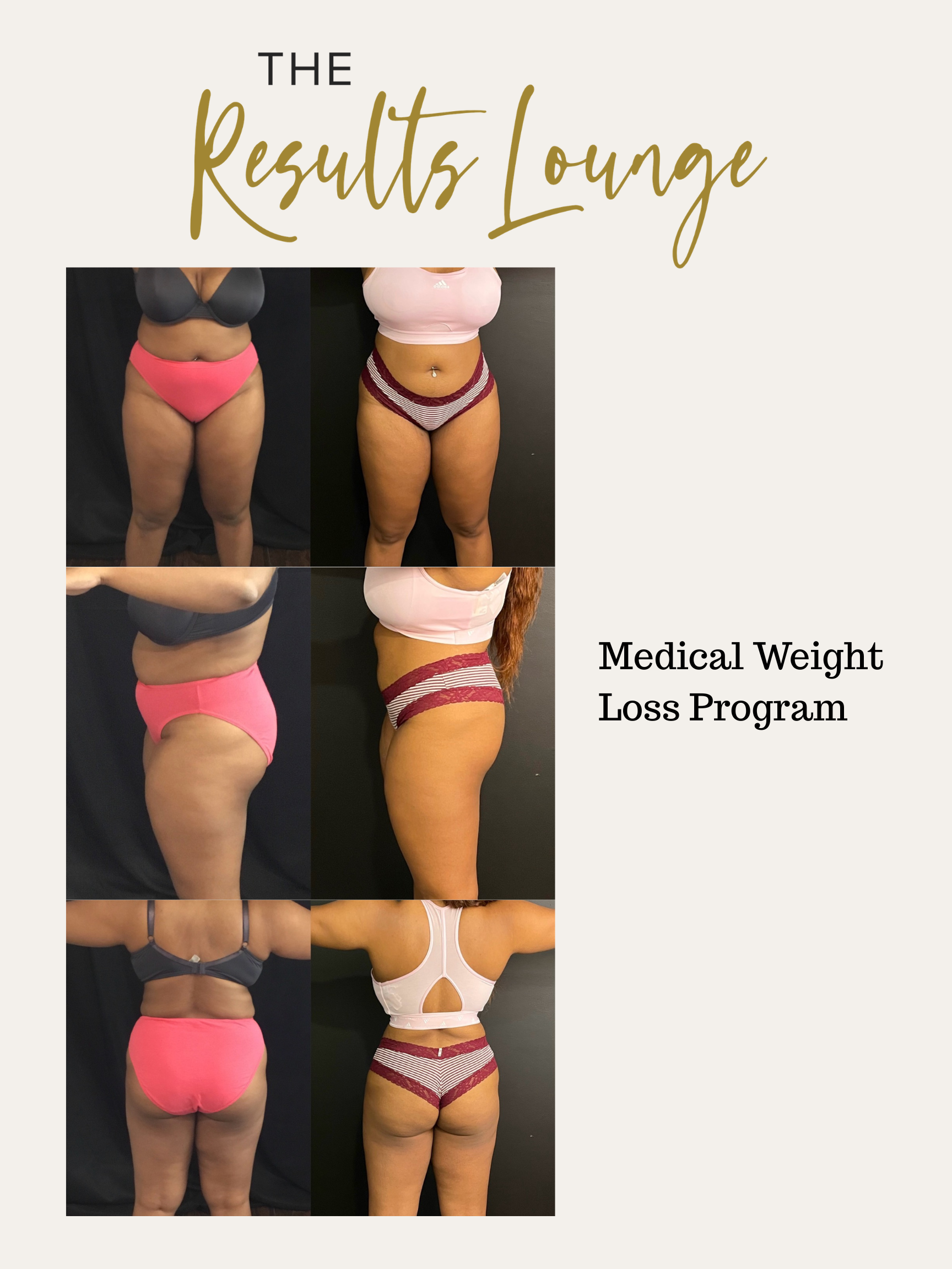 Before and After (10).png