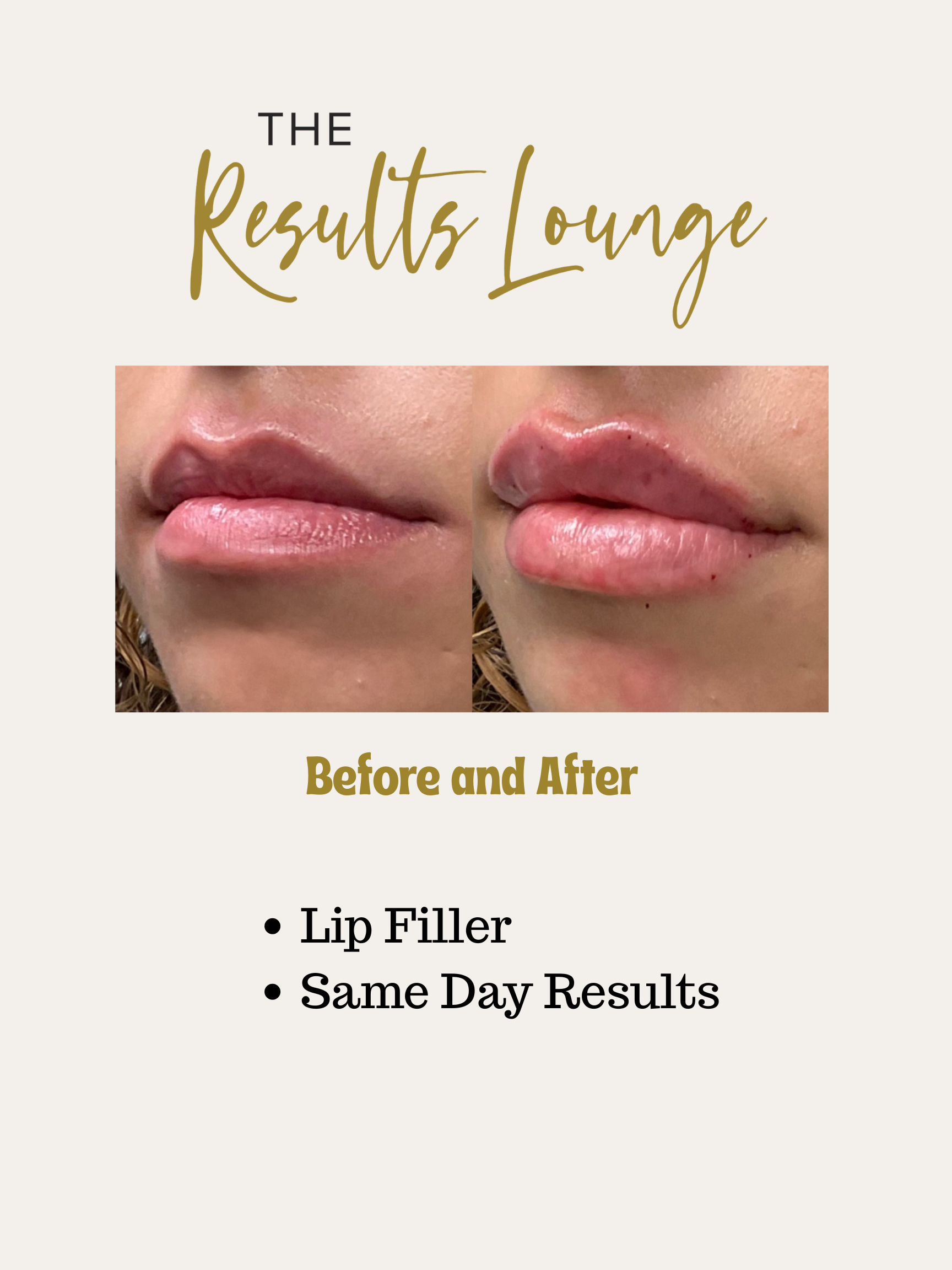 Before and After (14).png