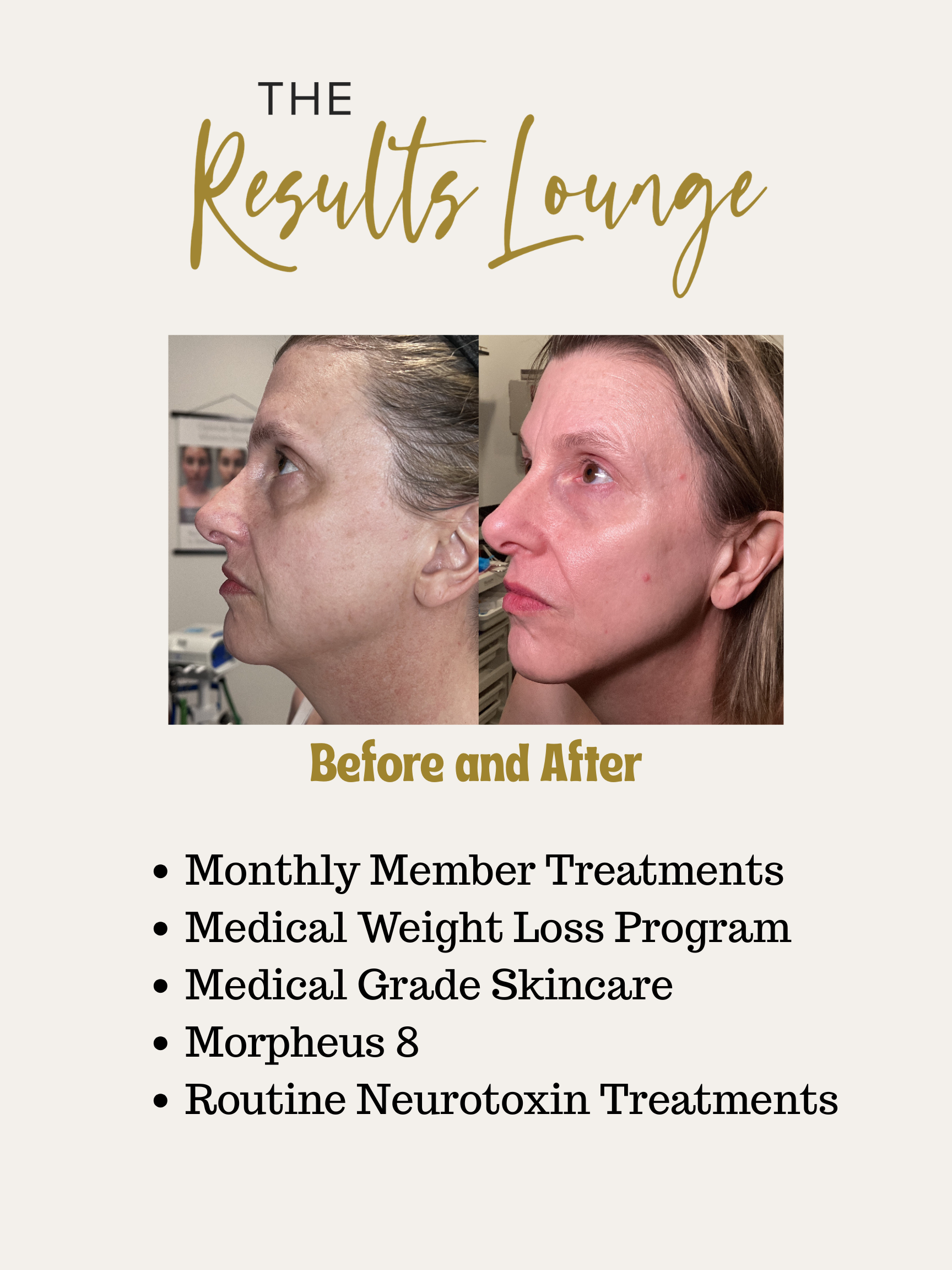 Before and After (31).png