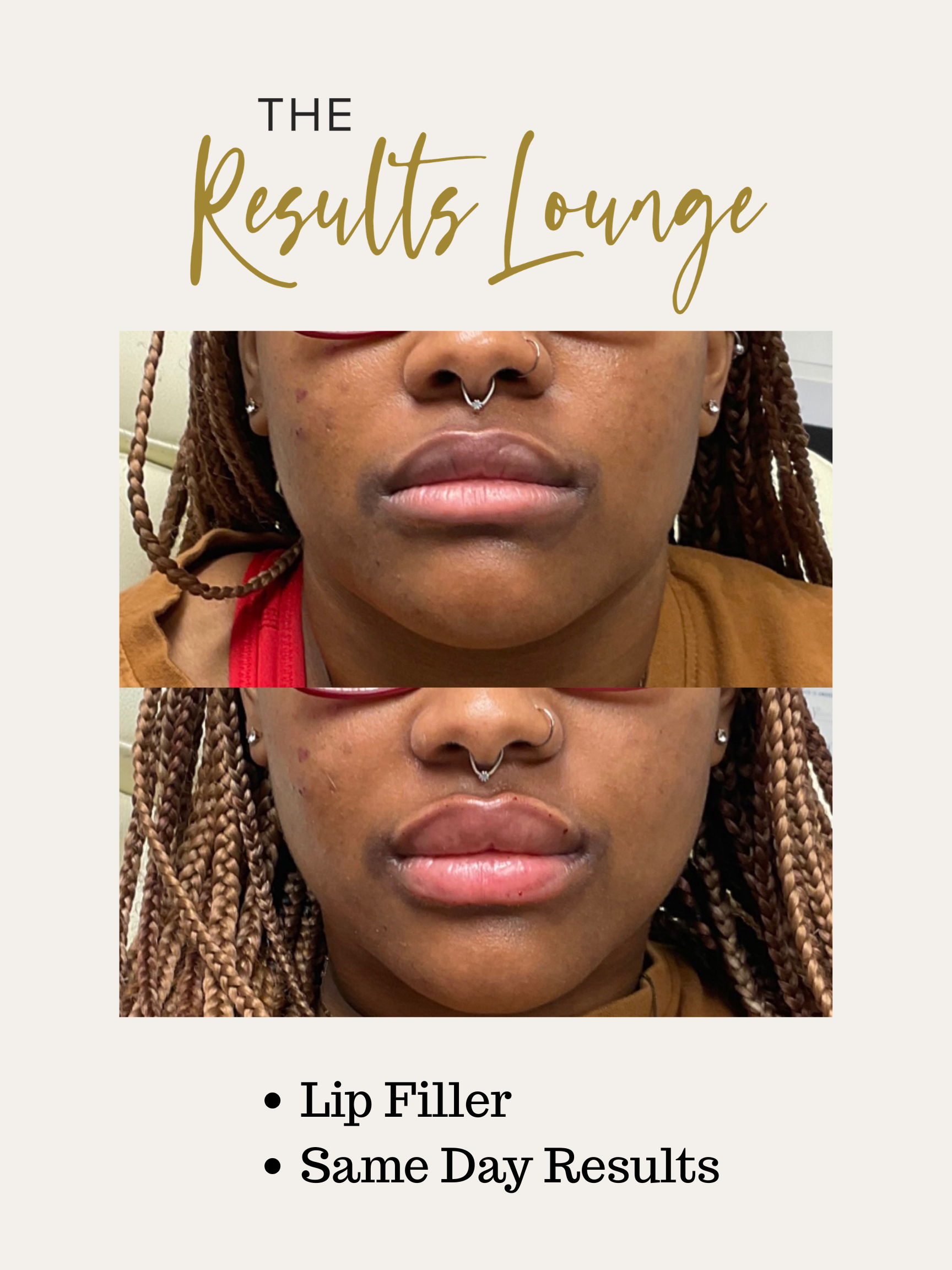 Before and After (13).png