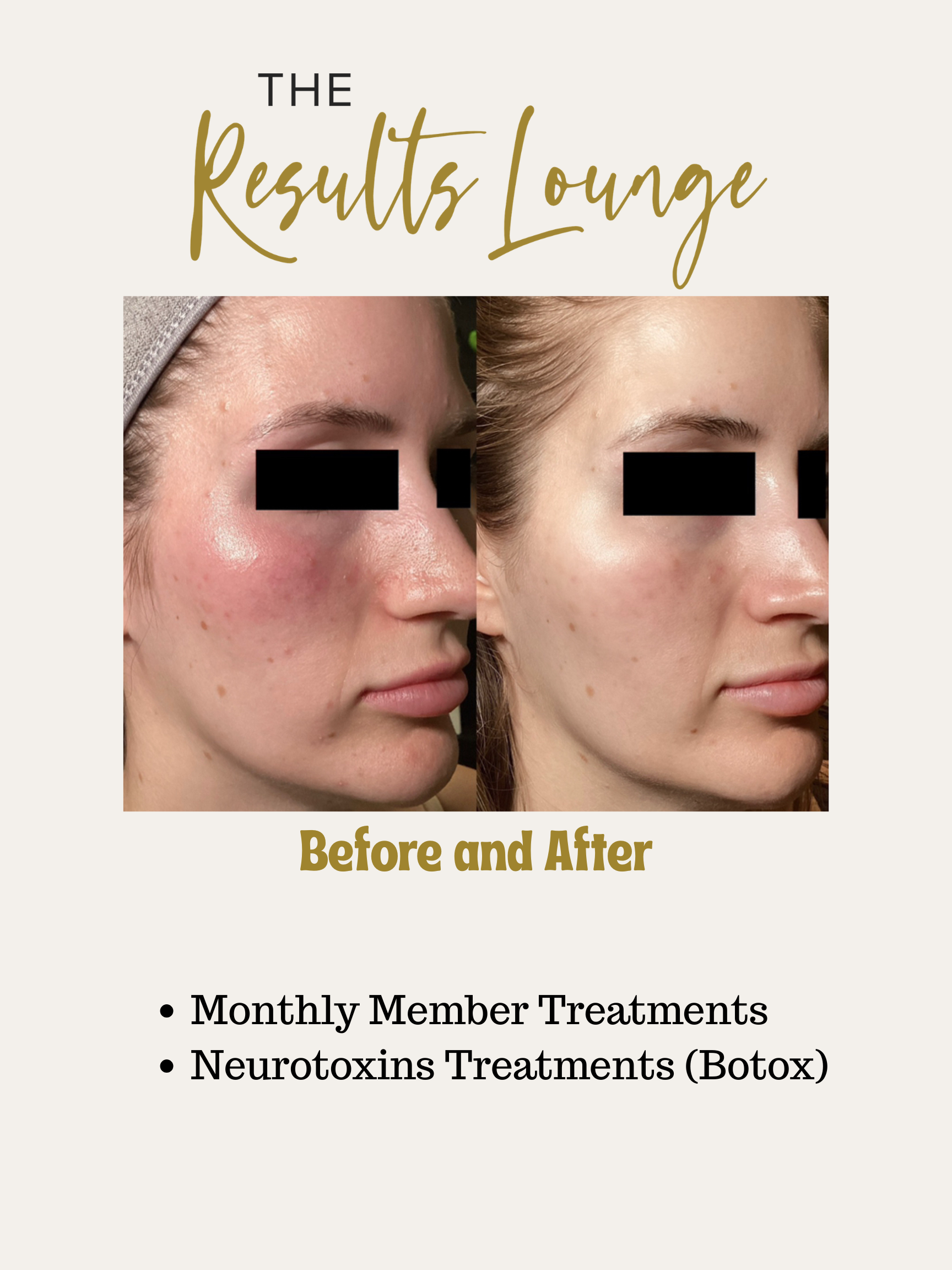 Before and After (4).png