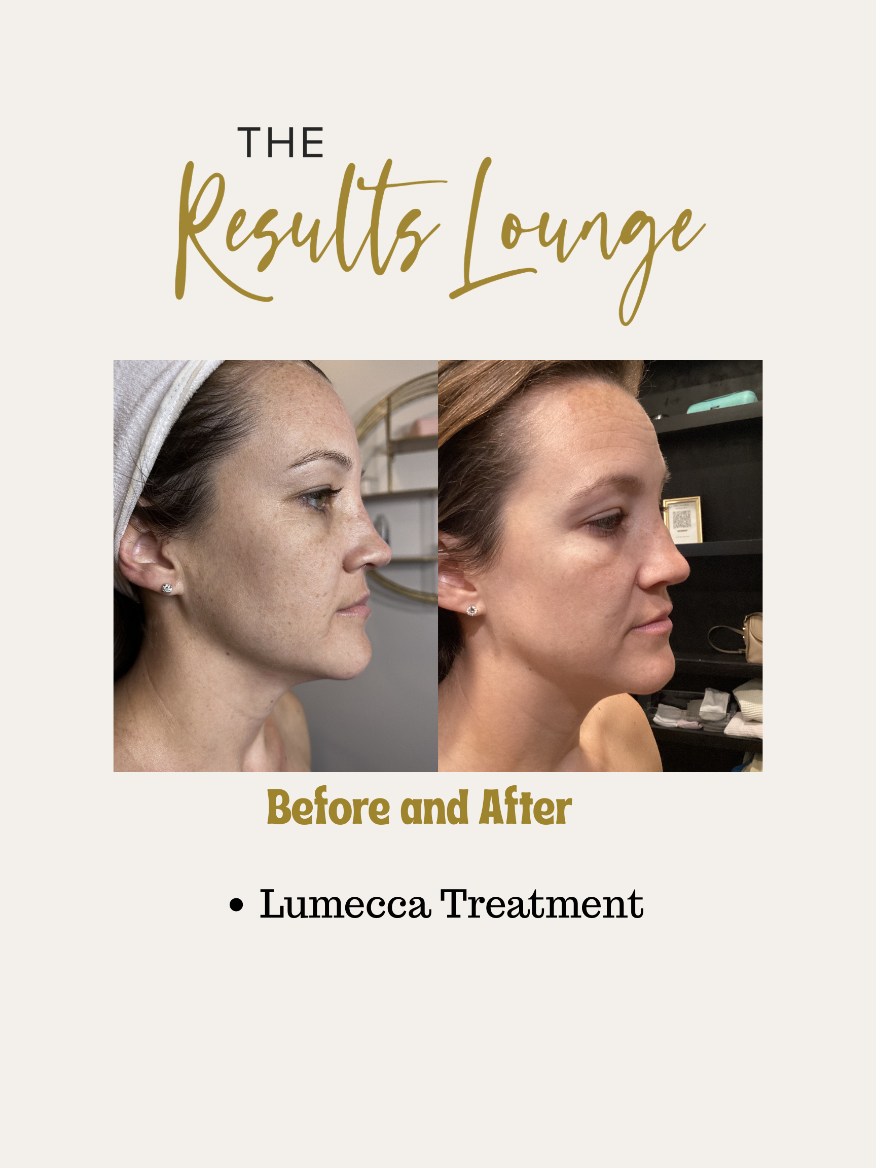 Before and After (18).png