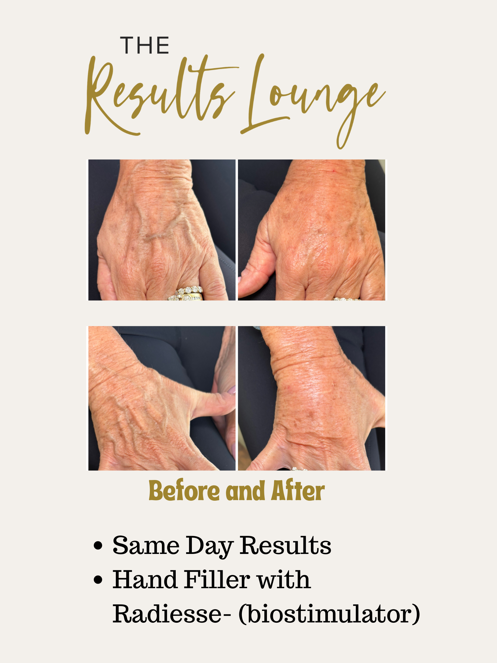 Before and After (6).png