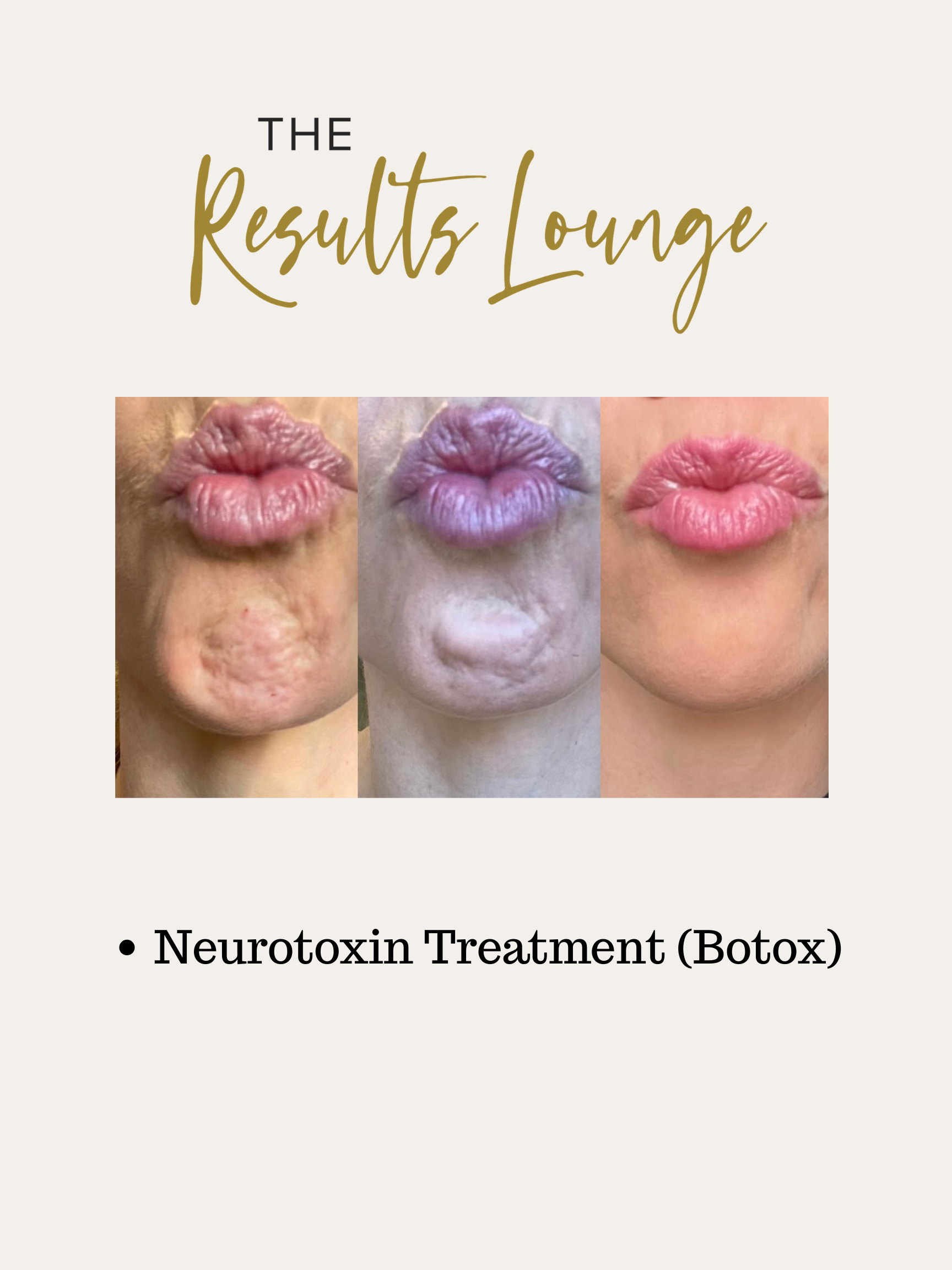 Before and After (15).png