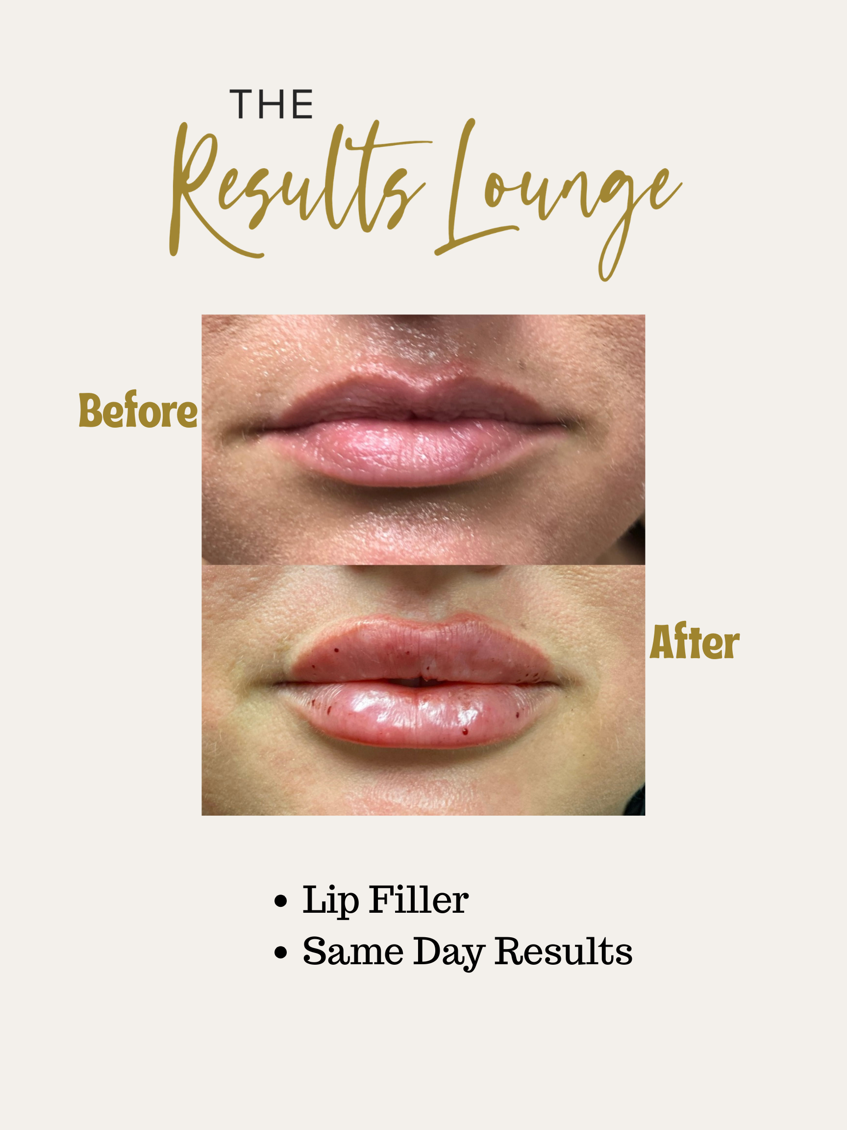 Before and After (37).png