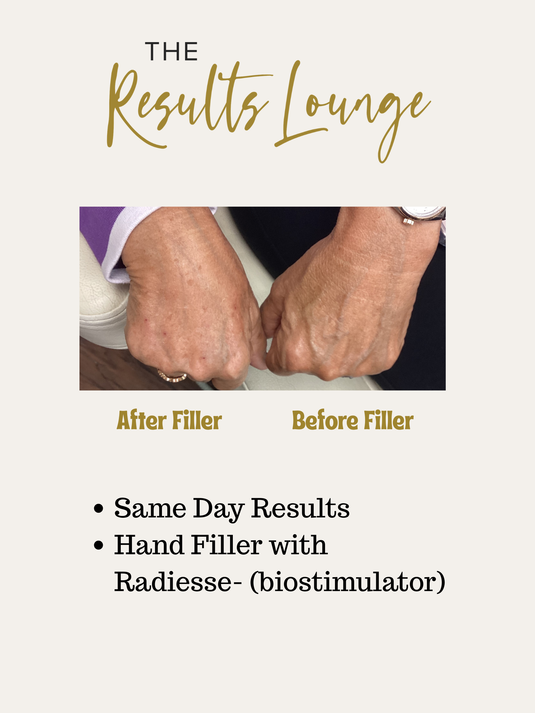 Before and After (7).png