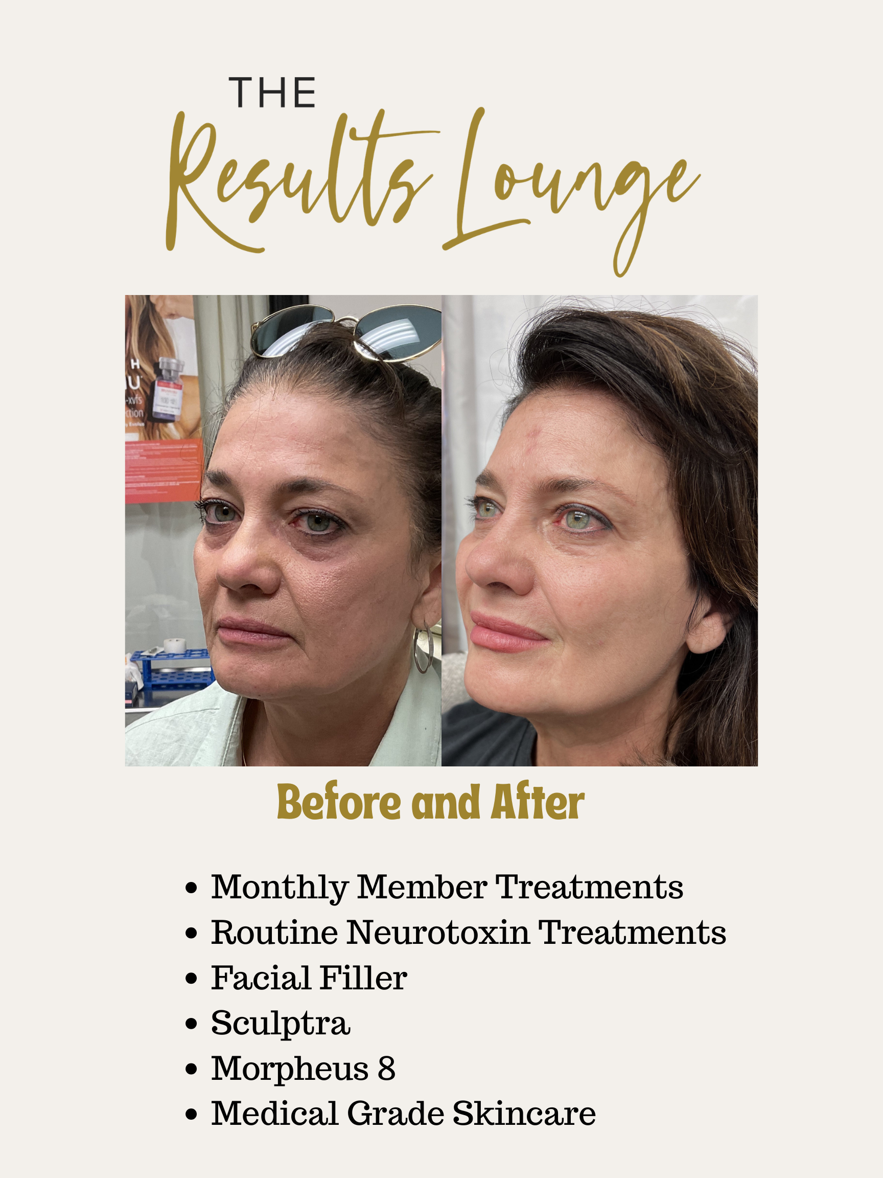 Before and After (21).png